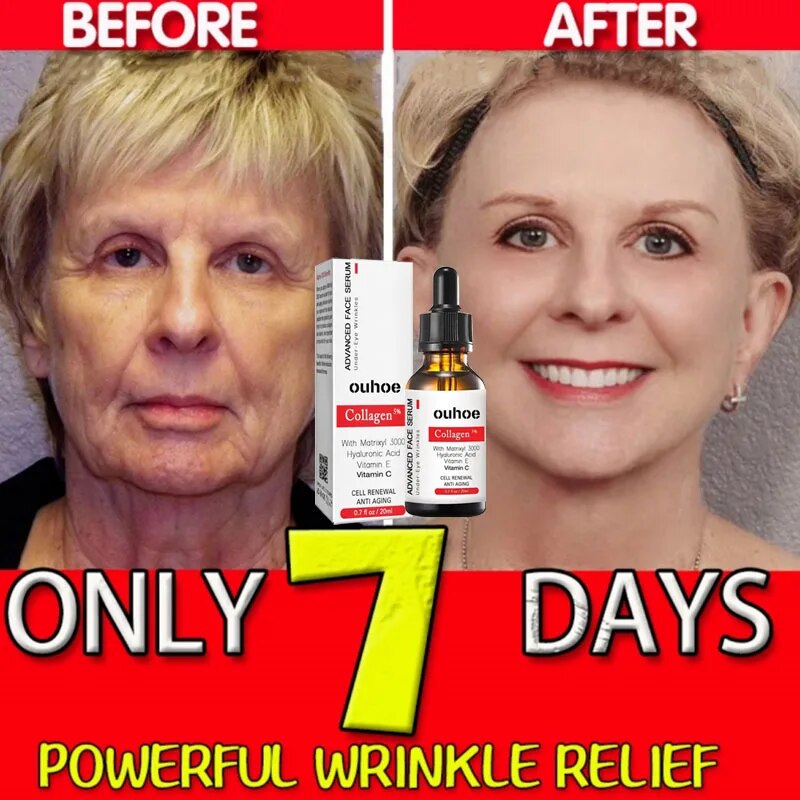 Cuidado de la belleza tienda arrugas colágeno eliminar suero facial reafirmante esencia antienvejecimiento desvanecimiento líneas finas blanqueamiento hidratante piel Coche_voghion.com