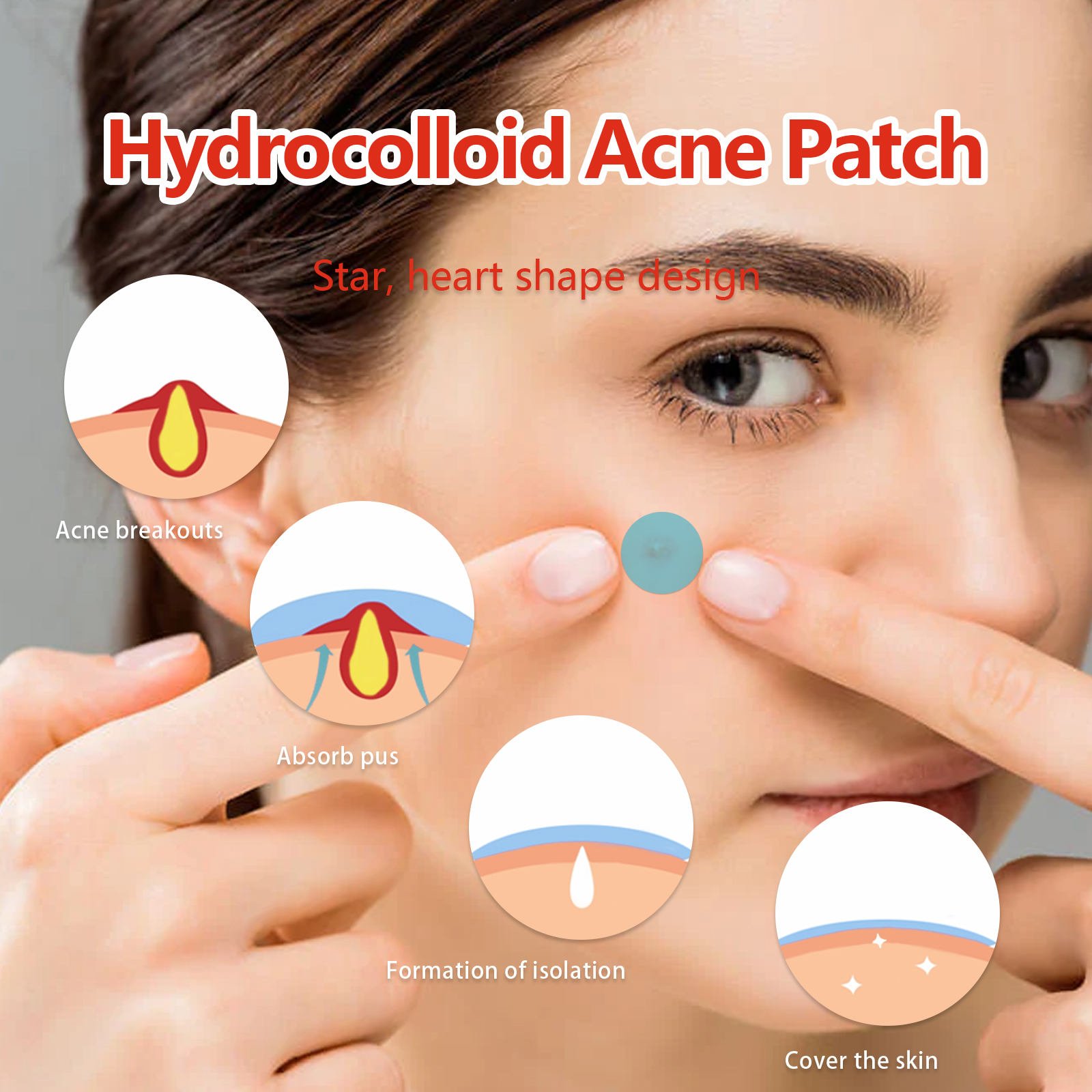 EELHOE Hydrocolloid Acne Patch, Mild Non-Irritant Lightening Acne Pimples Closed Mouth Improve Acne Muscle Hydrocolloidal Acne Patch_voghion.com