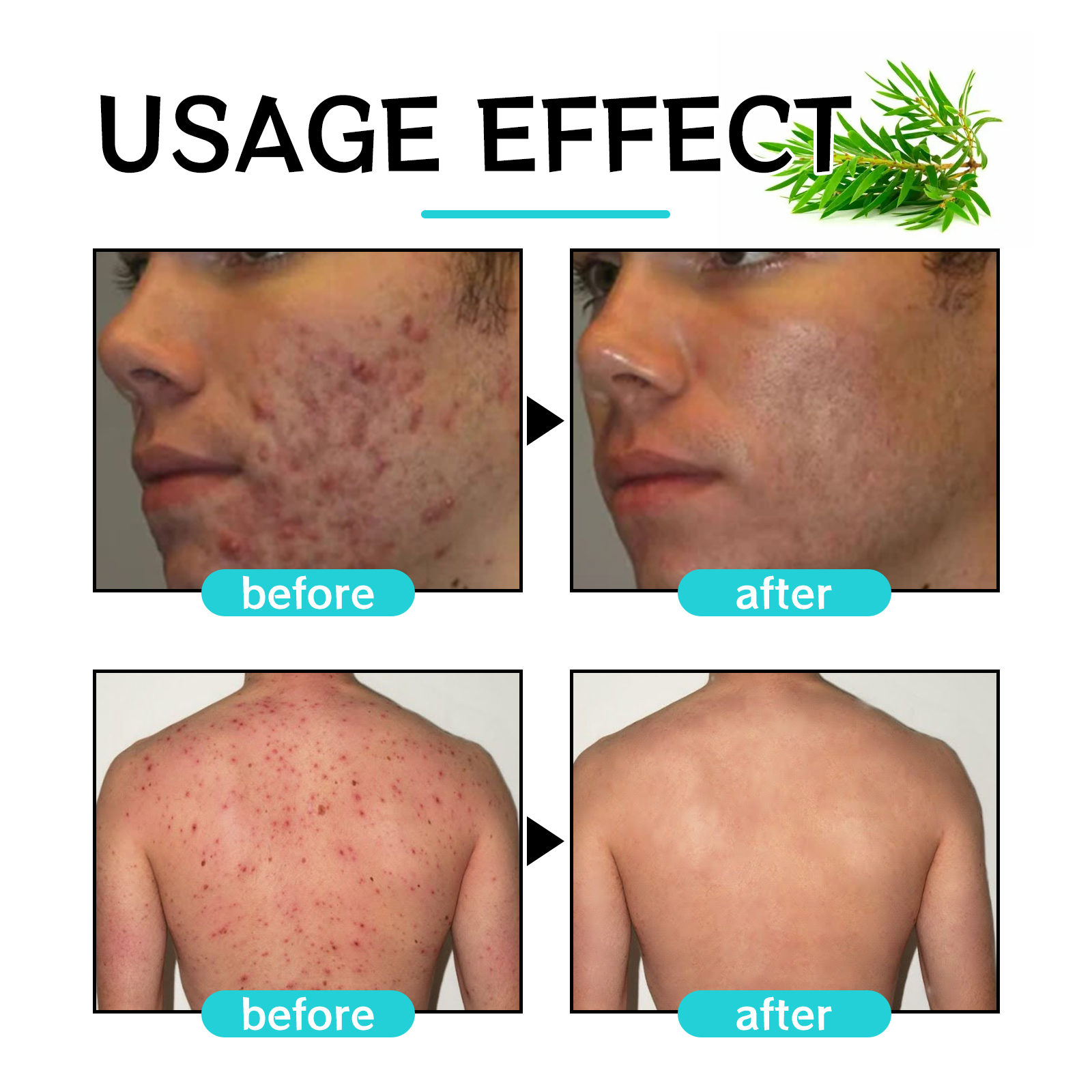 EELHOE Aurora Purifying Mite-Removing Soap, Deep Cleansing Facial Body Skin Fade Acne Print Multi-Effect Cleansing Soap_voghion.com