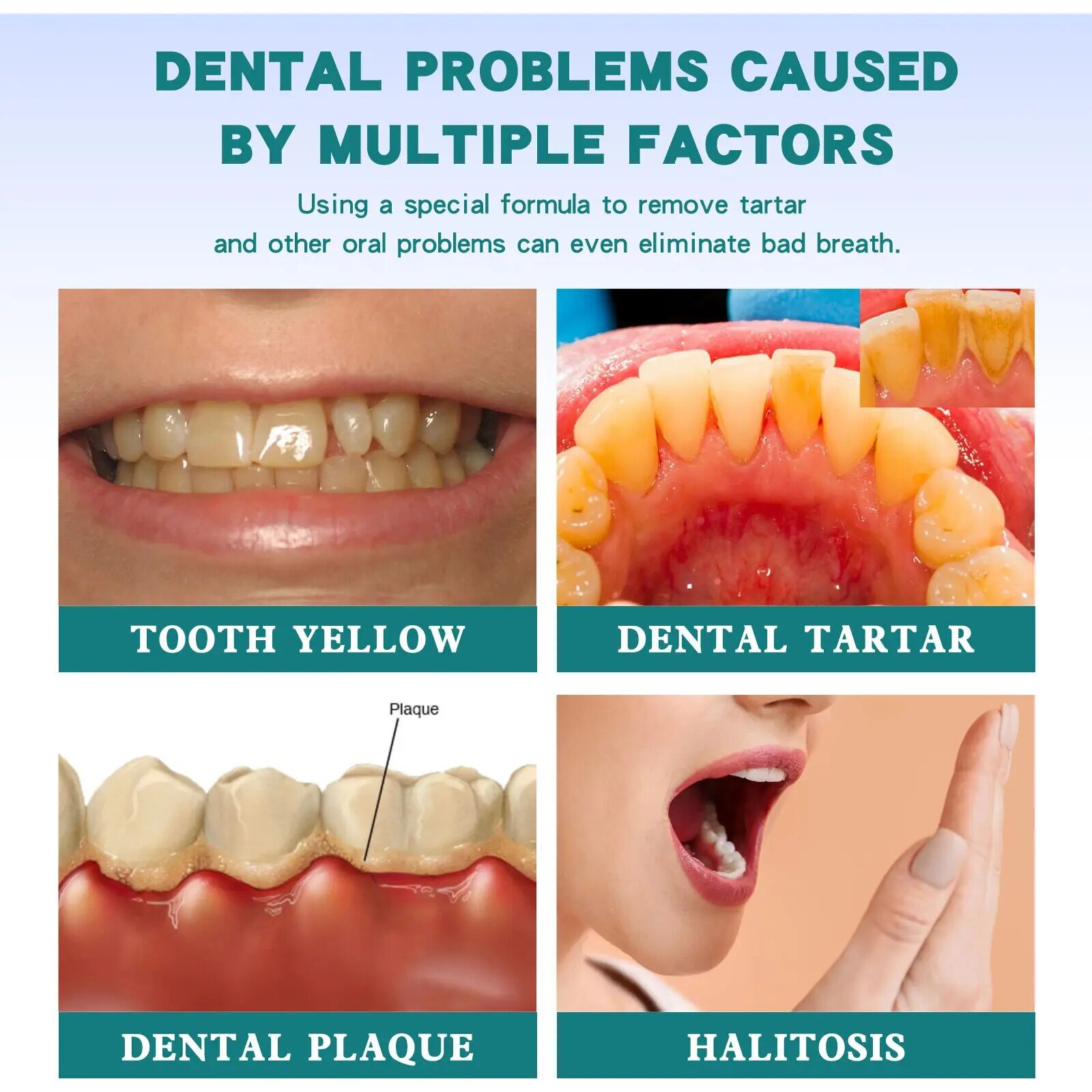 Negozio di bellezza Riparazione Sbiancamento Jaysuing Liquido detergente macchie gialle, le macchie dei denti sono più efficaci_voghion.com