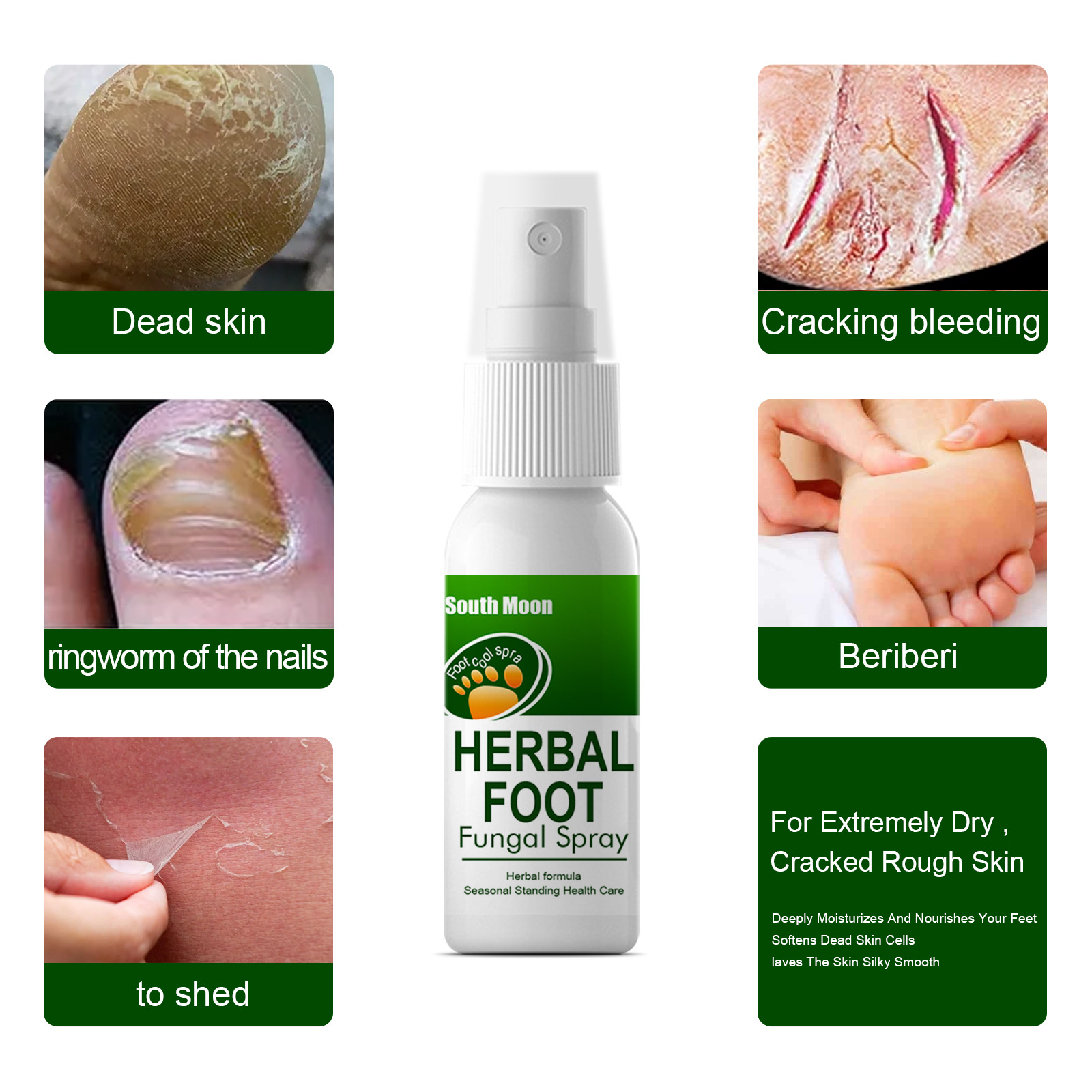 Sweat, Herbal spray Odor and Itch Relieving Foot Care Spray_voghion.com