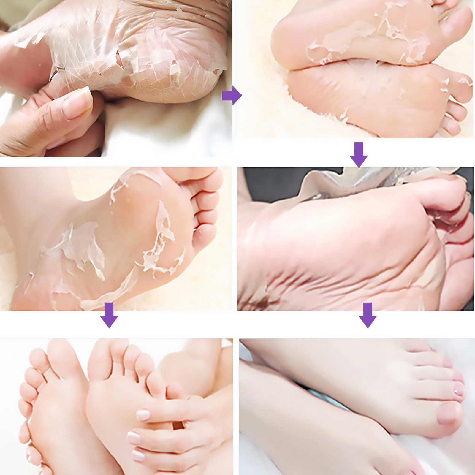 EELHOE Ginger Foot Mask (Box) Foot Moisturizing, Nourishing, Rejuvenating, Exfoliating, Removing Dead Skin, Dry And Cracked Skin Care Foot Mask_voghion.com