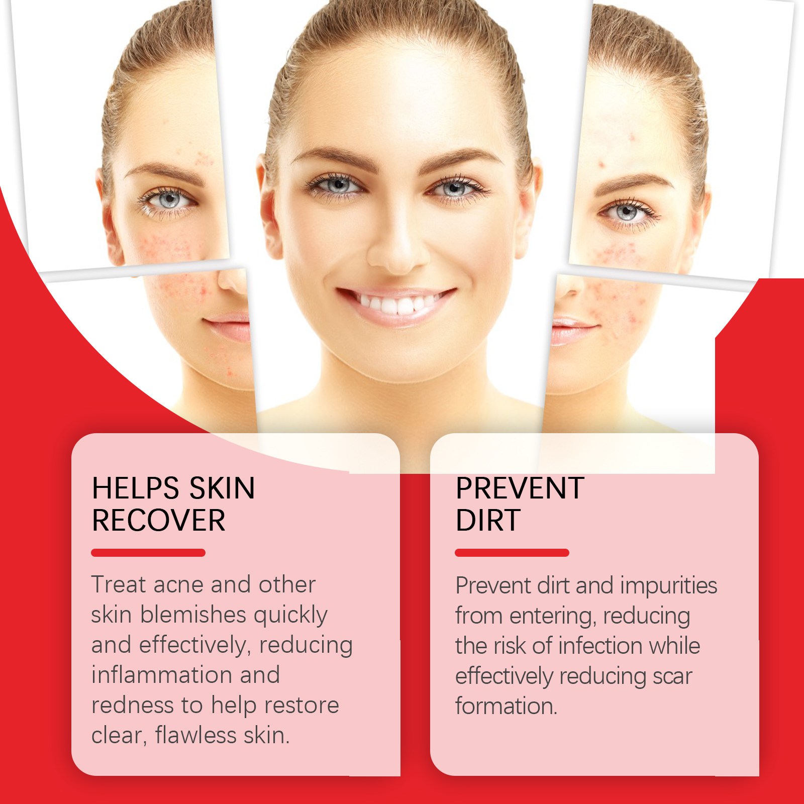 Jaysuing Blemish Acne Patch Clear Acne Face Cover Acne Care Facial Contact Patch_voghion.com