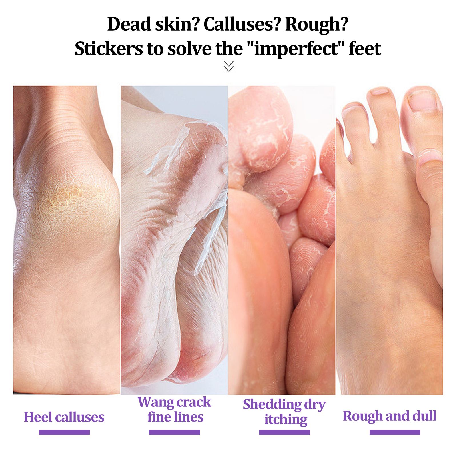 EELHOE Ginger Foot Mask (Box) Foot Moisturizing, Nourishing, Rejuvenating, Exfoliating, Removing Dead Skin, Dry And Cracked Skin Care Foot Mask_voghion.com