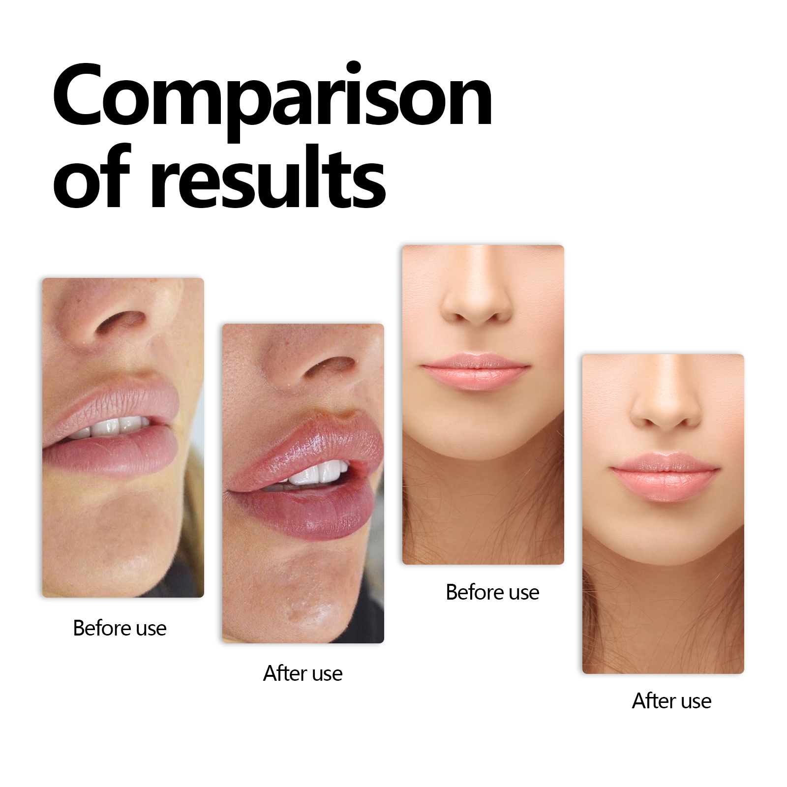 EELHOE Lip Serum Lip Moisturizing, Anti-Cracking, Hydrating, Hydrating And Smoothing Lip Lines_voghion.com