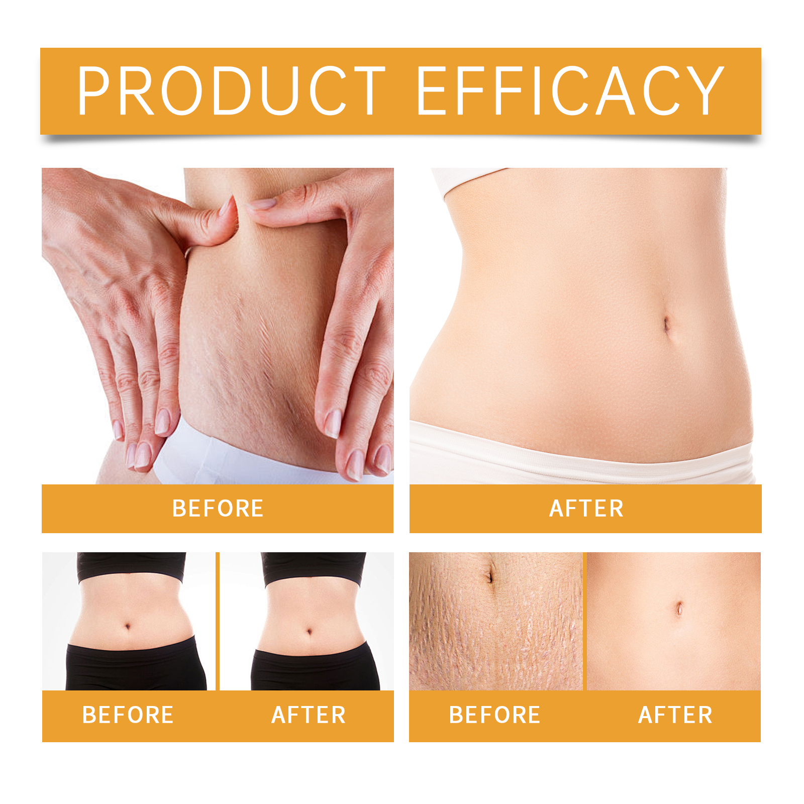 EELHOE Abdominal Firming Serum Nourishes Skin And Moisturizes It_voghion.com