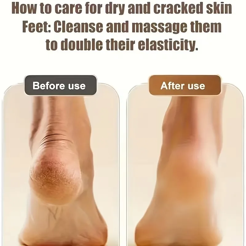 Râpe pieds électrique rechargeable anti callosités_voghion.com