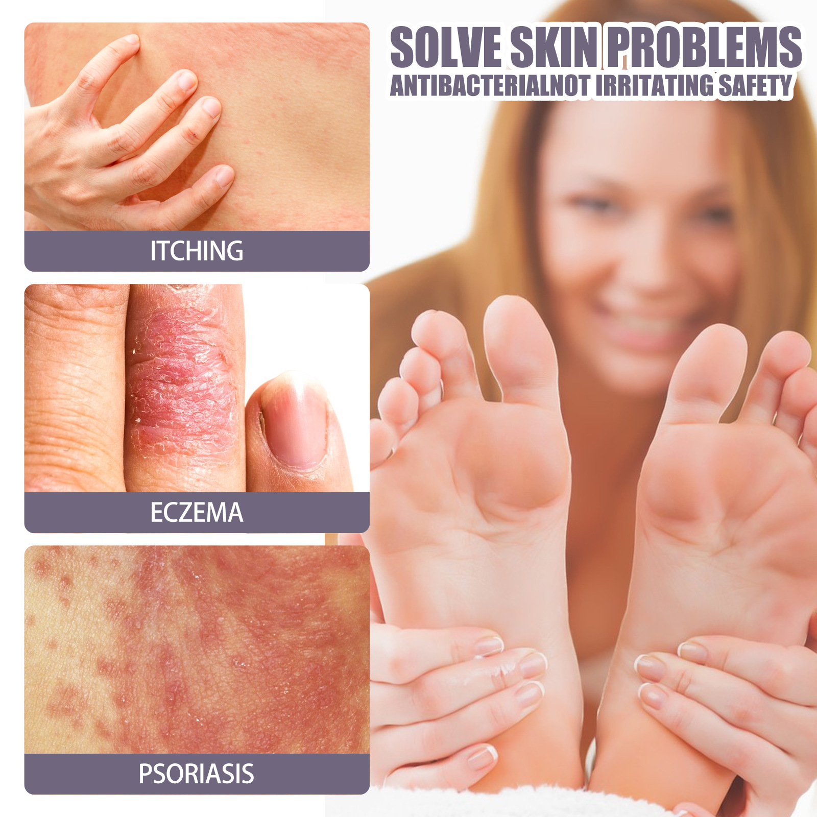 EELHOE riparazione del muschio mano-piede per alleviare il prurito e spray per la cura della pelle Jiejia_voghion.com