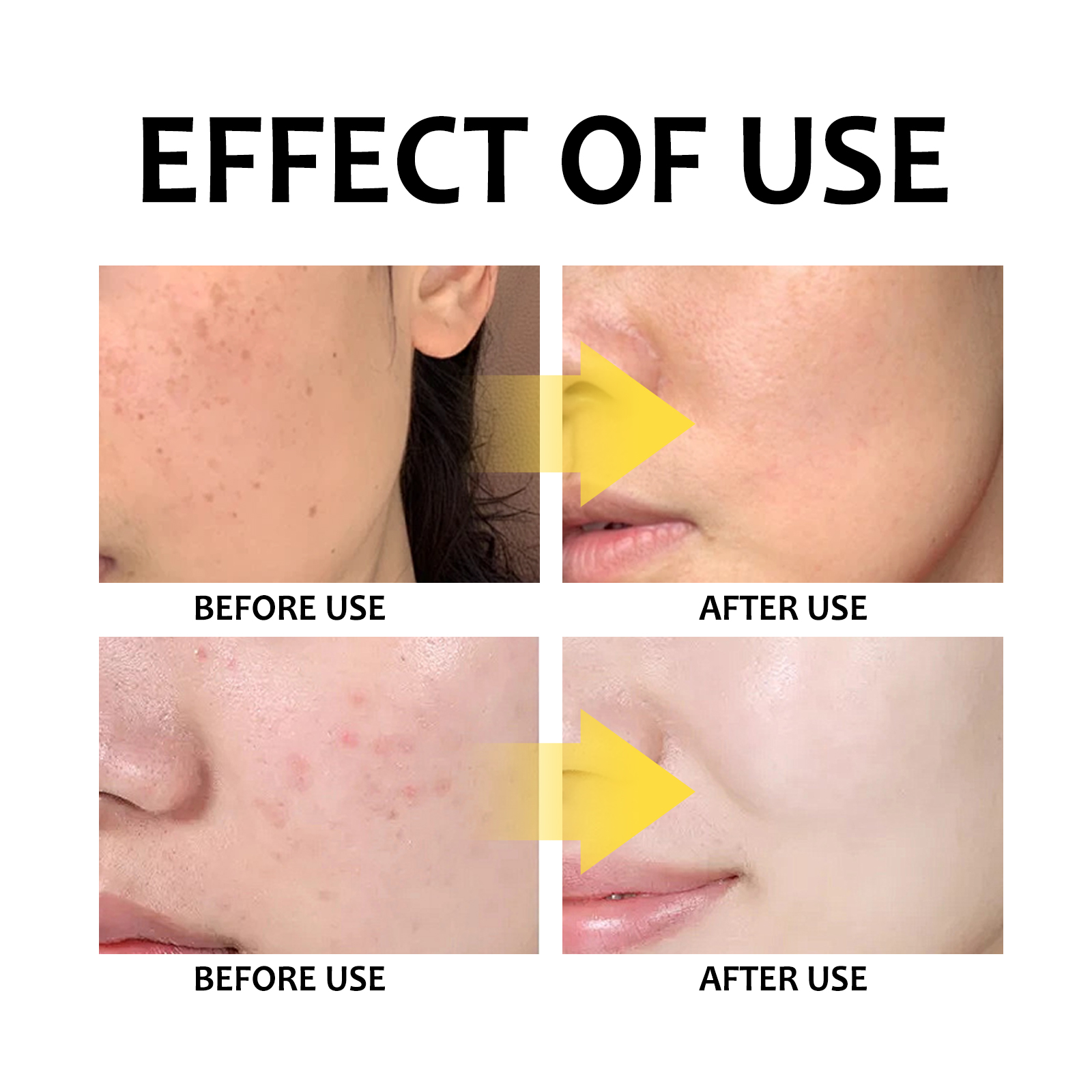 Eelhoe Turmeric Cleansing Pad Deeply Cleanses Skin, Removes Dirt, Controls Oil And Softens Exfoliated And Tender Ski_voghion.com