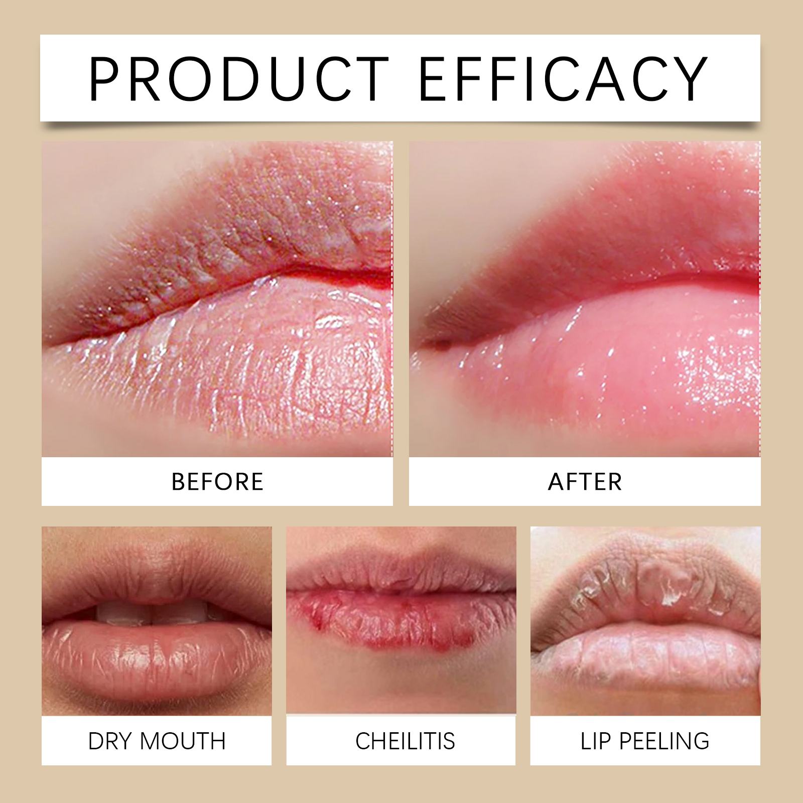 Jaysuing Lip Area Serum, Hydrating, Moisturizing, Smoothing And Moisturizing Lip Care Serum_voghion.com