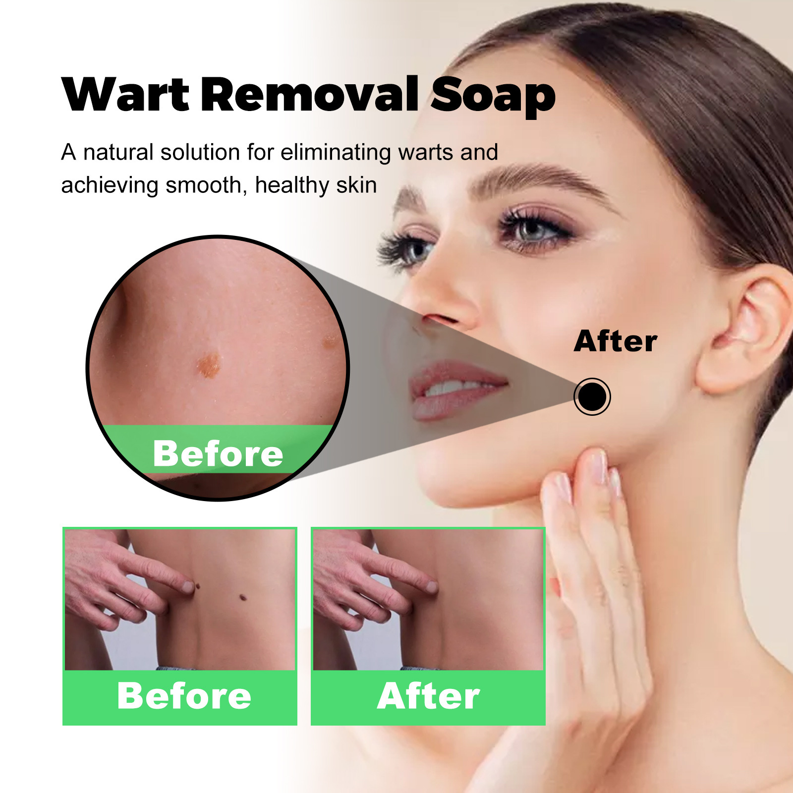 South Moon for Facial, Neck, Body, Cleaning and Care Anti wart Smooth Skin Soap_voghion.com