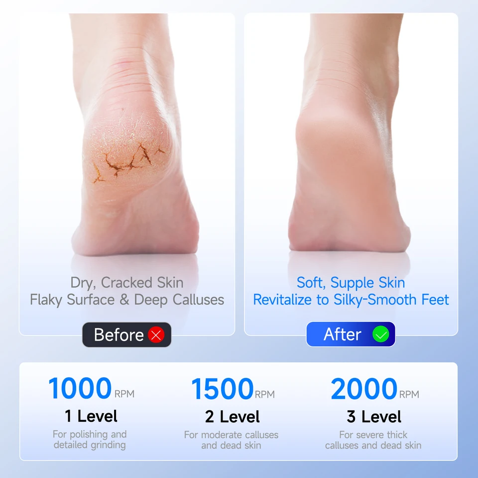 Râpe pieds électrique étanche pour éliminer les callosités pieds_voghion.com