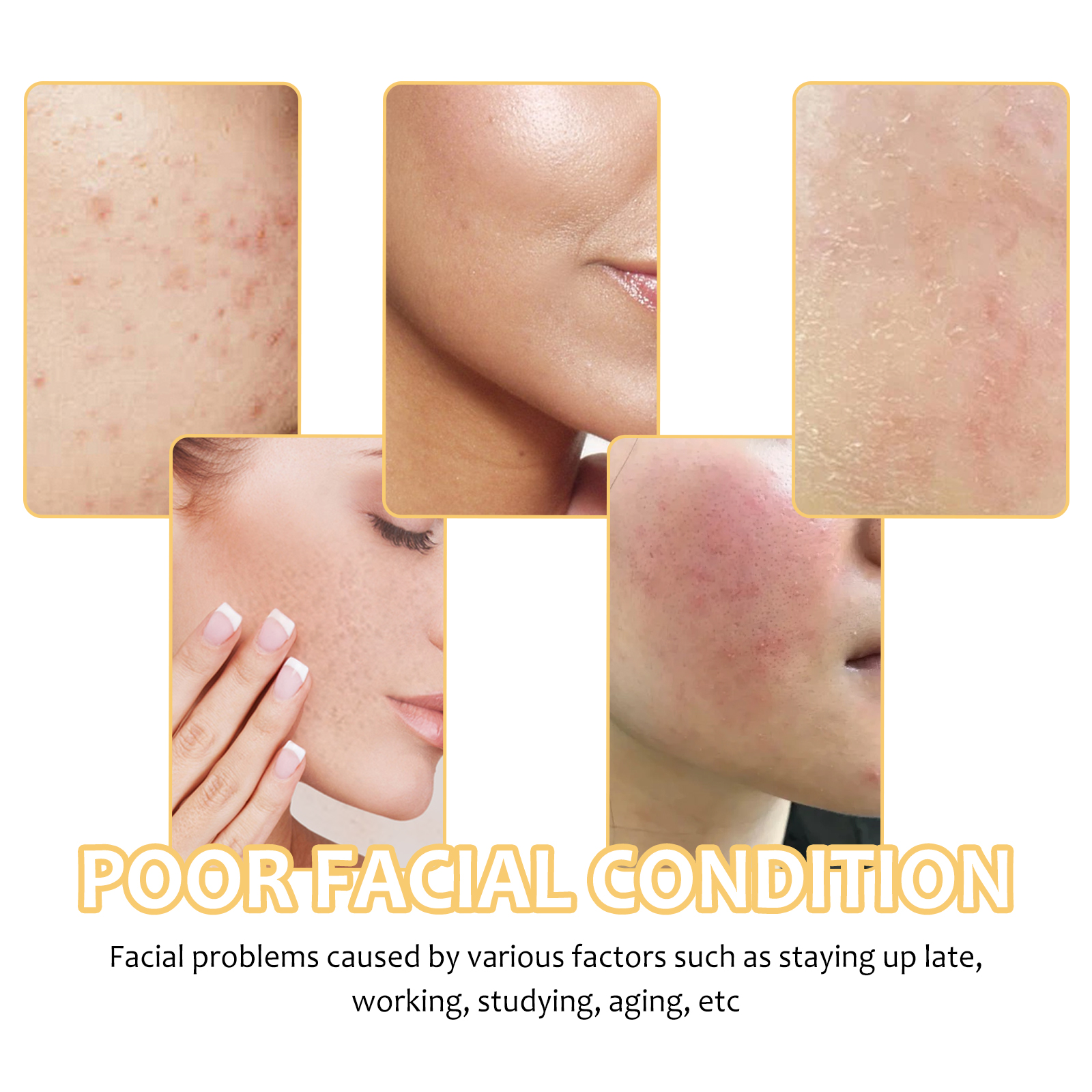 Eelhoe Turmeric Cleansing Pad Deeply Cleanses Skin, Removes Dirt, Controls Oil And Softens Exfoliated And Tender Ski_voghion.com