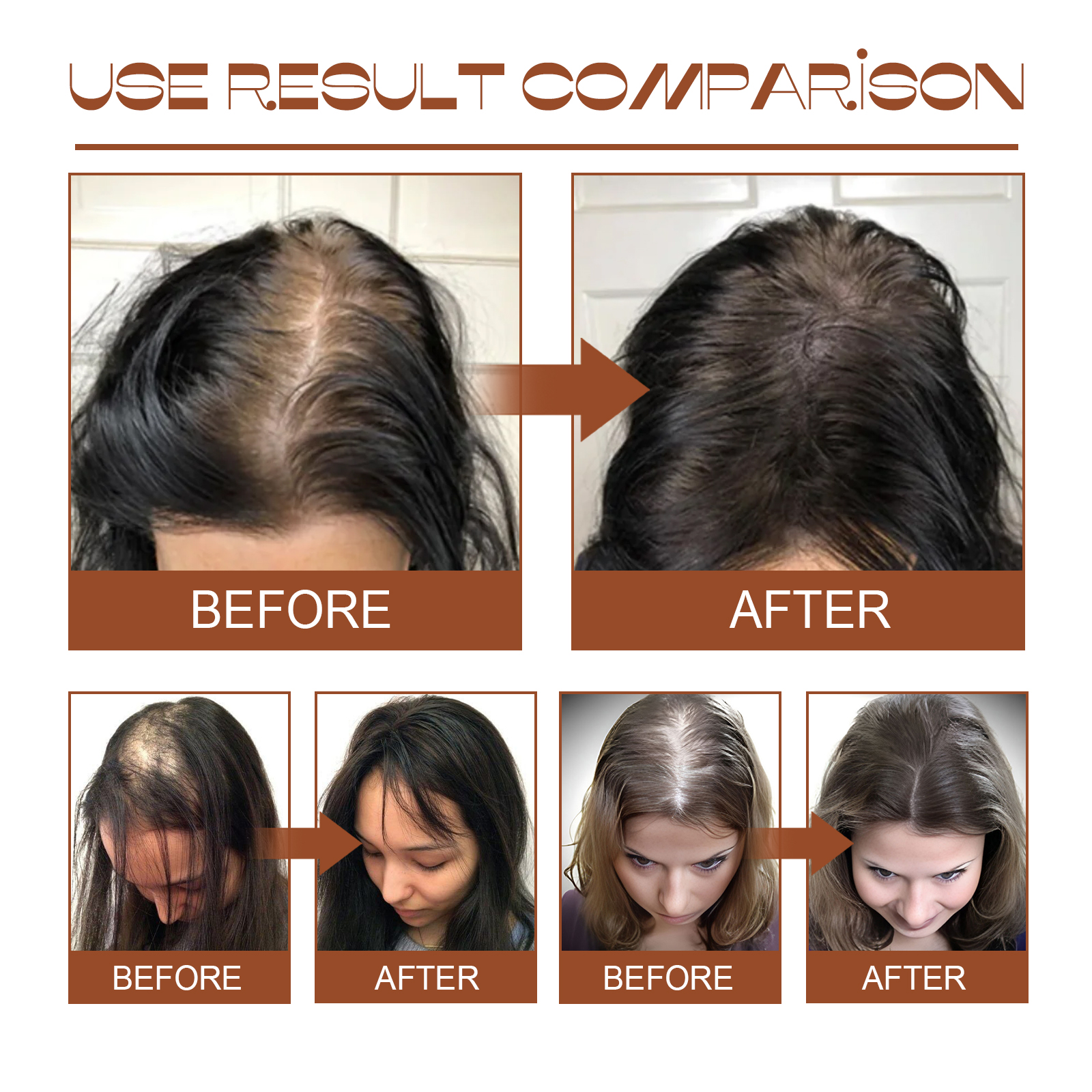 EELHOE Batana-Öl-Conditioner, feuchtigkeitsspendend und hydratisierend, verbessert die Pflege von trockenem, krausem, glattem und flauschigem Haar_voghion.com