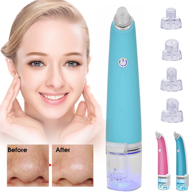 Rimozione di punti neri, aspirazione a vuoto, pulizia dei pori del viso, dermoabrasione idratante, strumento di bellezza per la cura della pelle Black Dot_voghion.com