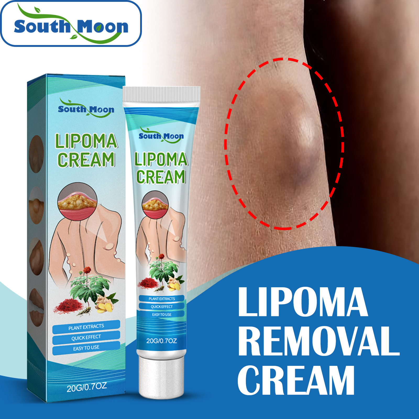 South Moon Lump allevia i tumori sottocutanei dei grumi di grasso e la crema per la cura del corpo schiarente_voghion.com