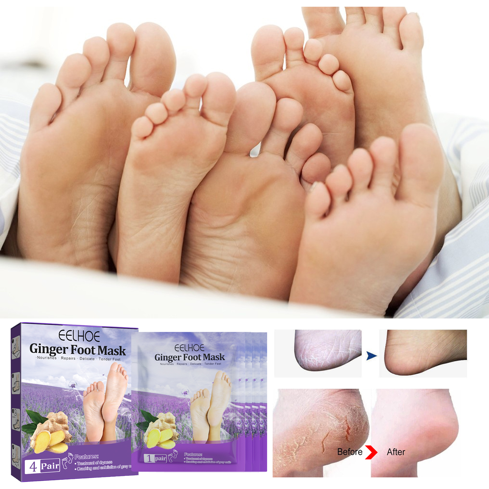 EELHOE Ginger Foot Mask (Box) Foot Moisturizing, Nourishing, Rejuvenating, Exfoliating, Removing Dead Skin, Dry And Cracked Skin Care Foot Mask_voghion.com