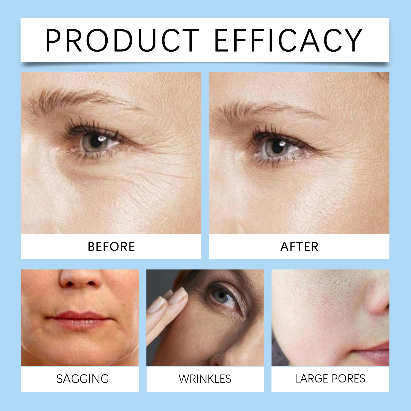 EELHOE Vitamin B5 Salicylic Acid Gel Mask Gently Cleans Pores And Blackheads To Nourish And Moisturize Skin_voghion.com