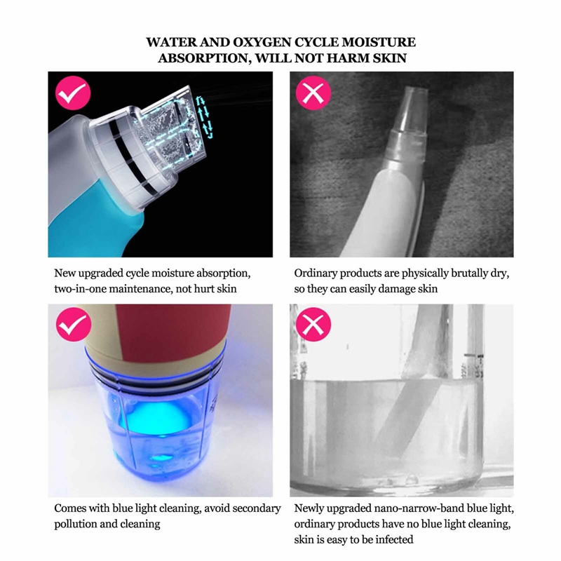 Rimozione di punti neri, aspirazione a vuoto, pulizia dei pori del viso, dermoabrasione idratante, strumento di bellezza per la cura della pelle Black Dot_voghion.com