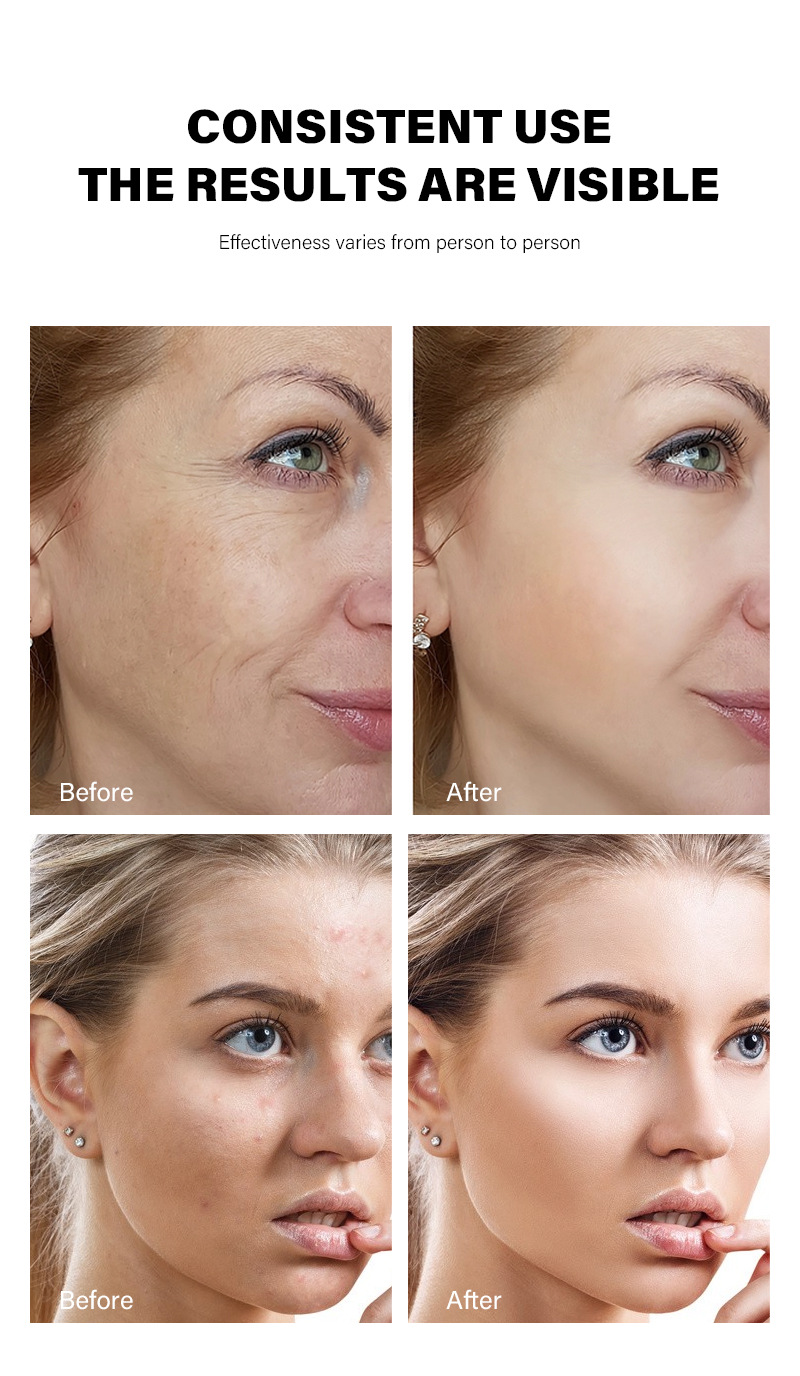 Retinol MOIKA Anti Wrinkle to Fade Fine Lines face cream,fade dark circles under the eyes_voghion.com