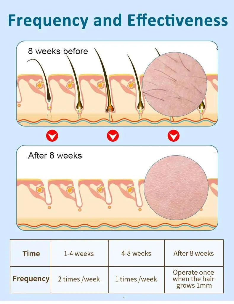 ACZT Quality Goods IPL Permanent Hair Removal - Bikini, Legs, Underarms, Pain-Free_voghion.com