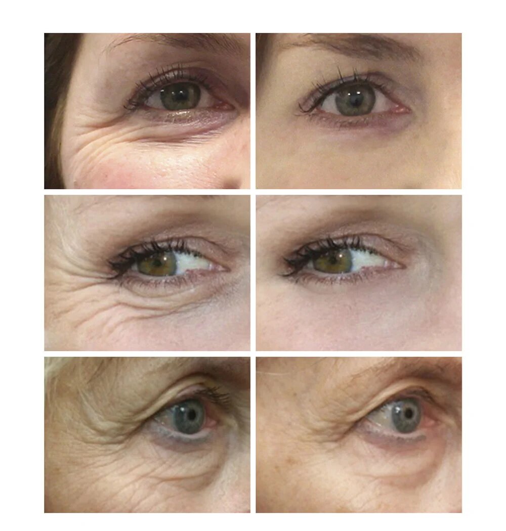 Negozio di prodotti per la cura della bellezza Siero Antirughe Borse per gli occhi Occhiaie Rimozione Essenza Rassodante Dissolvenza Linee sottili Anti-età Idratante B -invecchiamento_voghion.com
