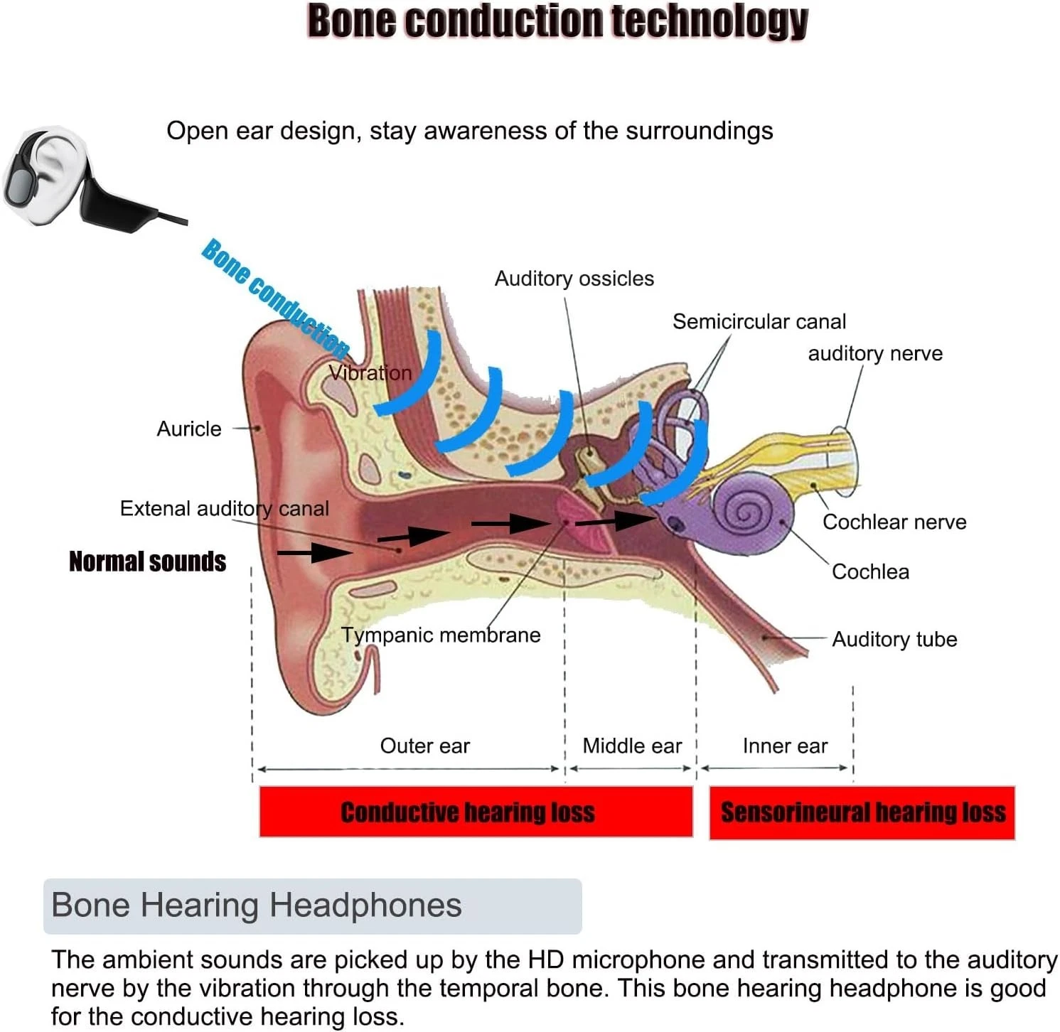Cuffie per problemi di conduzione ossea, cuffie wireless per assistenza uditiva._voghion.com