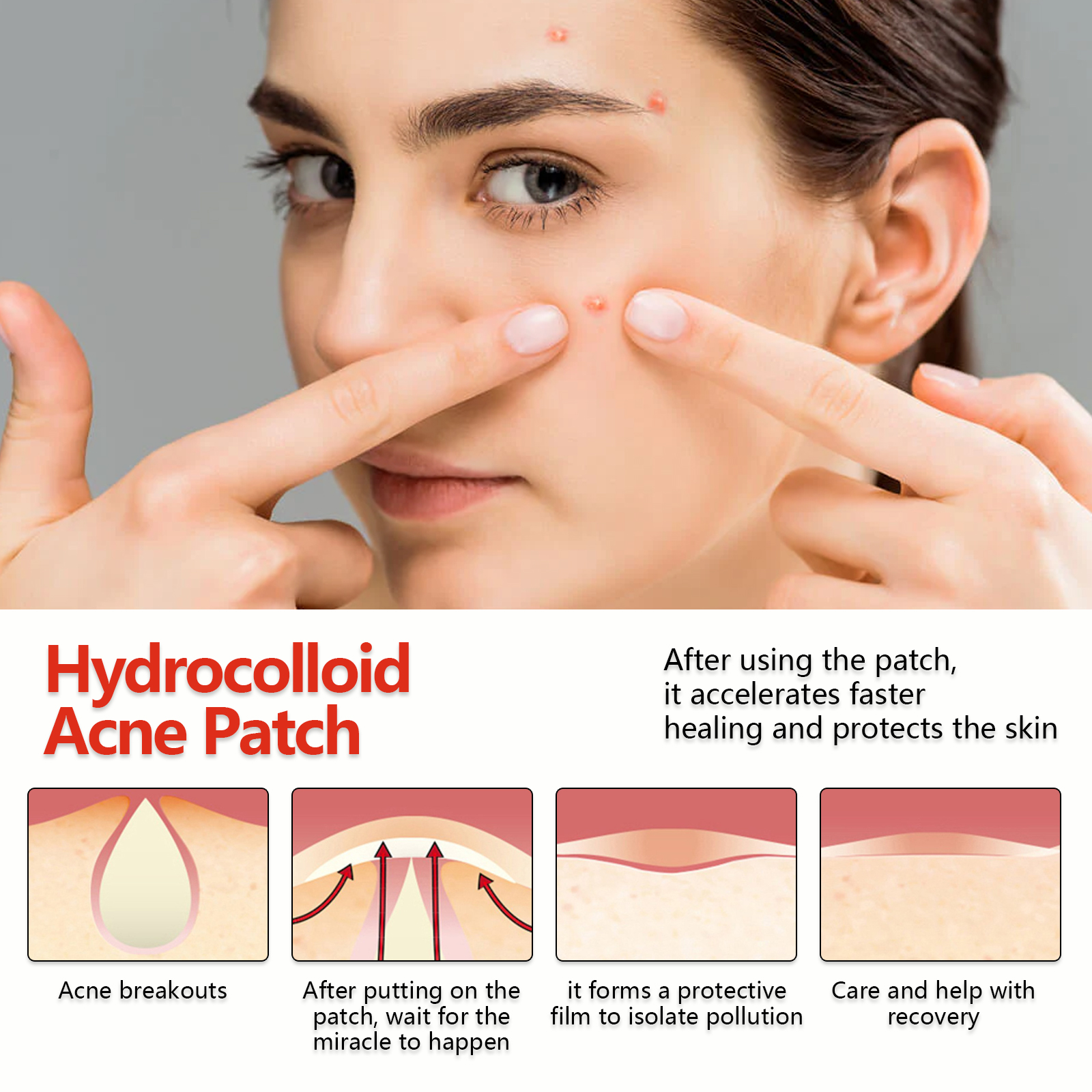 EELHOE Hydrocolloid Acne Patch, Mild Non-Irritant Lightening Acne Pimples Closed Mouth Improve Acne Muscle Hydrocolloidal Acne Patch_voghion.com