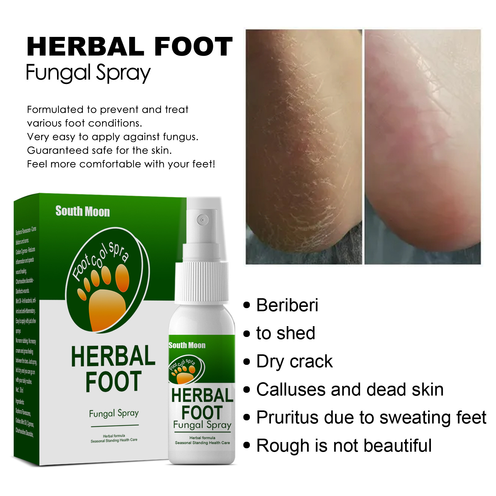 Sweat, Herbal spray Odor and Itch Relieving Foot Care Spray_voghion.com