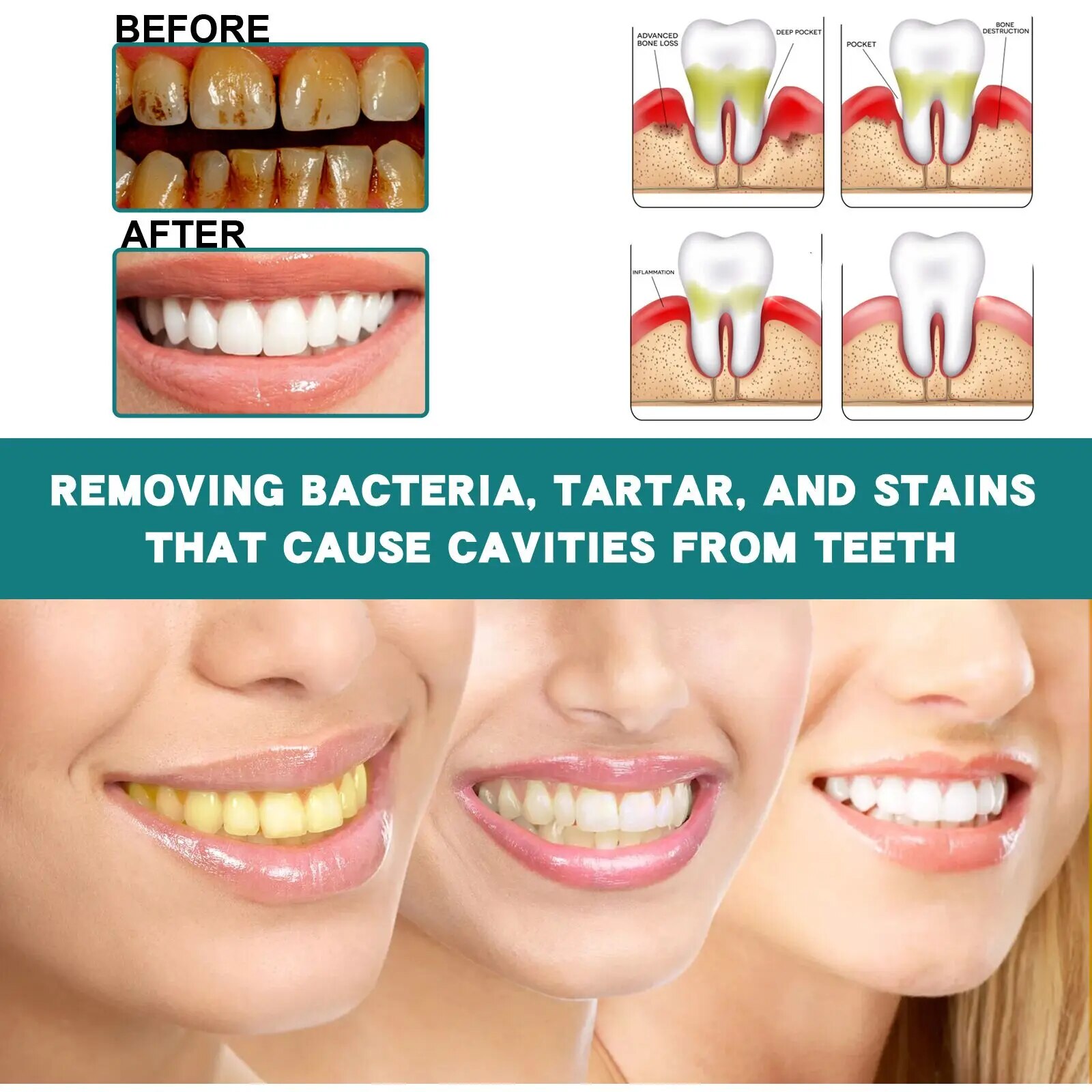 Negozio di bellezza Riparazione Sbiancamento Jaysuing Liquido detergente macchie gialle, le macchie dei denti sono più efficaci_voghion.com