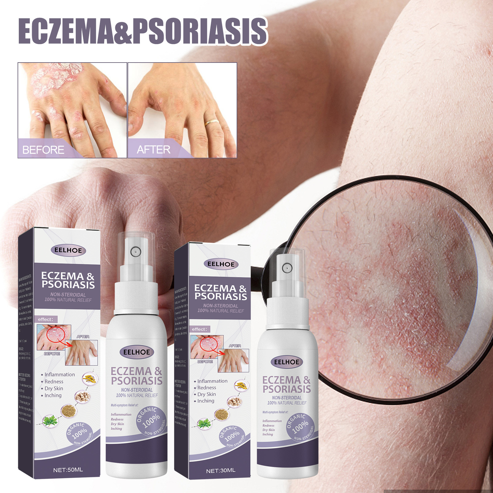 EELHOE riparazione del muschio mano-piede per alleviare il prurito e spray per la cura della pelle Jiejia_voghion.com
