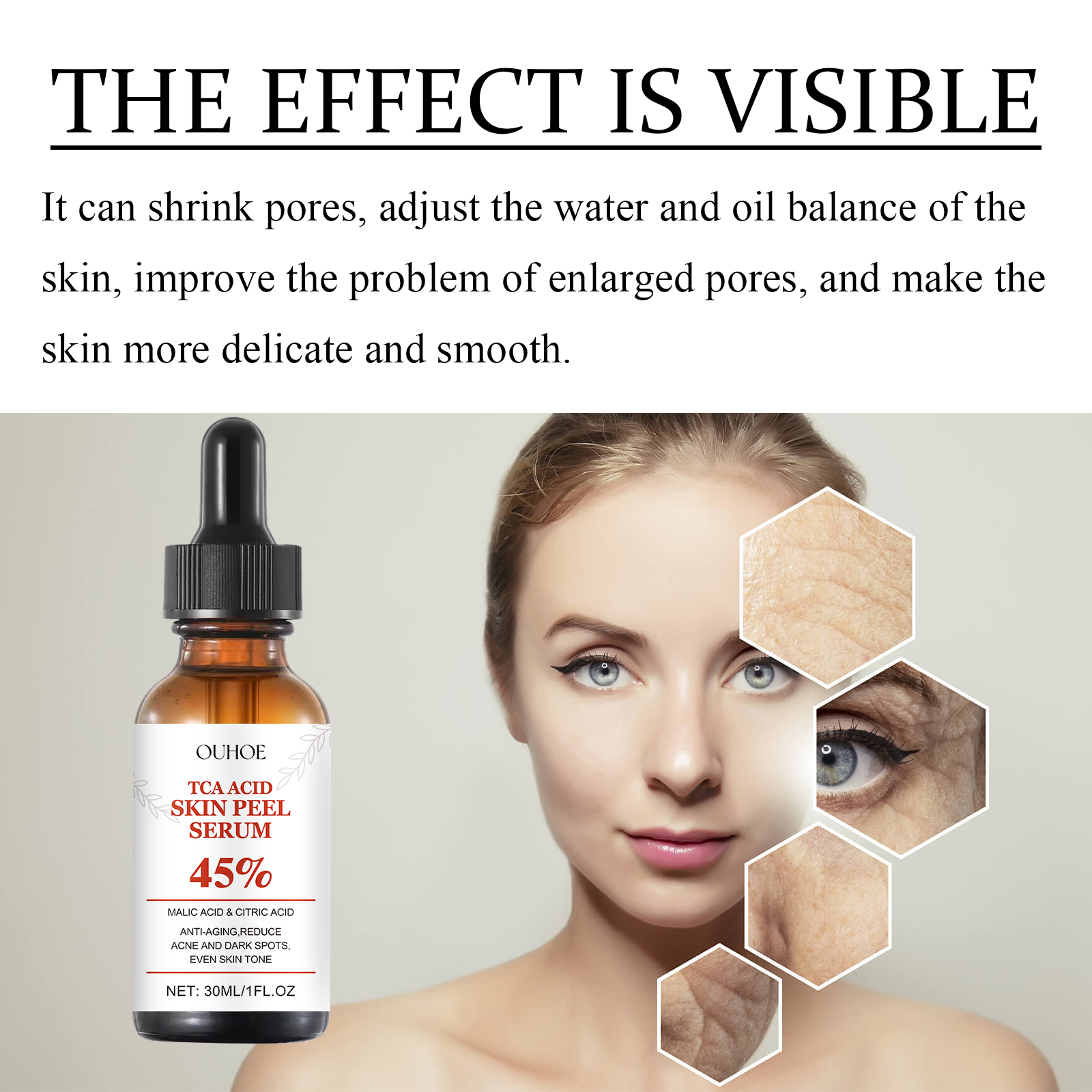 OUHOE TCA Acid Skin Peel Serum_voghion.com