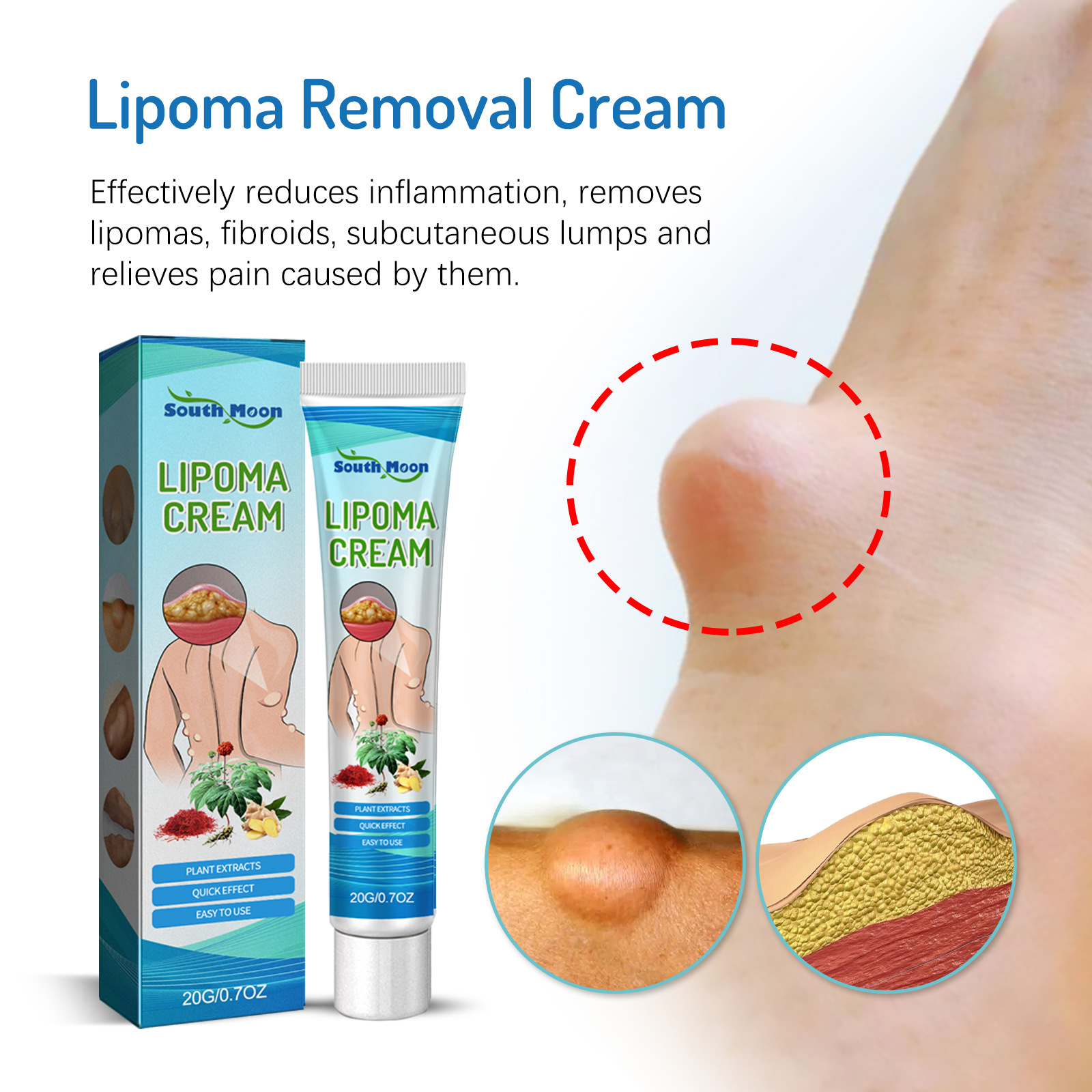 South Moon Lump allevia i tumori sottocutanei dei grumi di grasso e la crema per la cura del corpo schiarente_voghion.com
