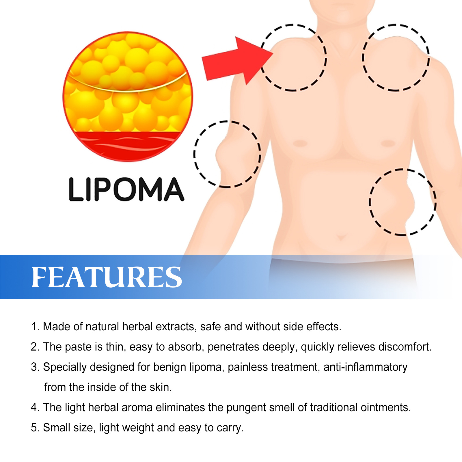 South Moon Lump allevia i tumori sottocutanei dei grumi di grasso e la crema per la cura del corpo schiarente_voghion.com