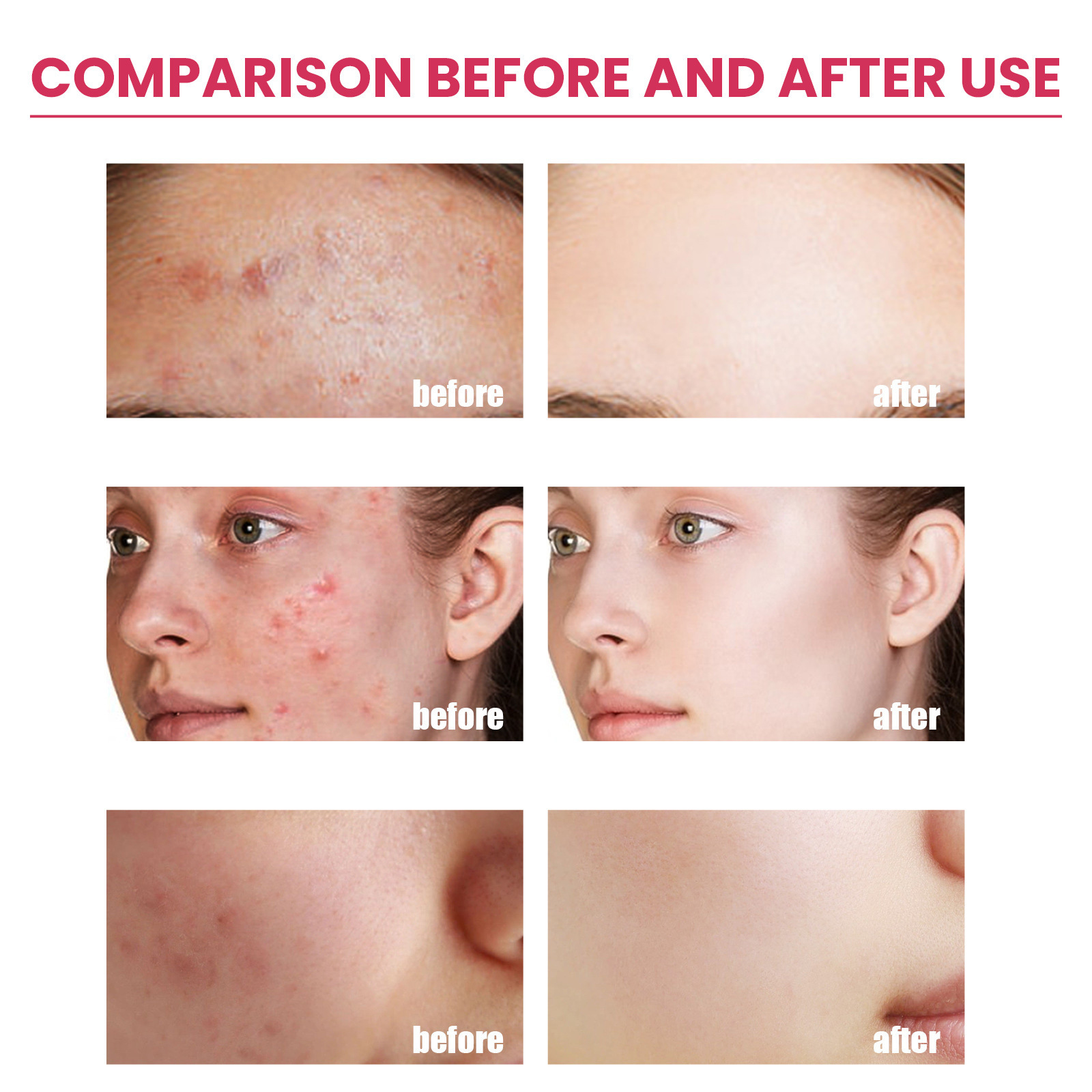 EELHOE Pore Shrink Cream, Lightening Acne Print Anti-Aging Moisturizing Whitening Skin Anti-Wrinkle Cream_voghion.com
