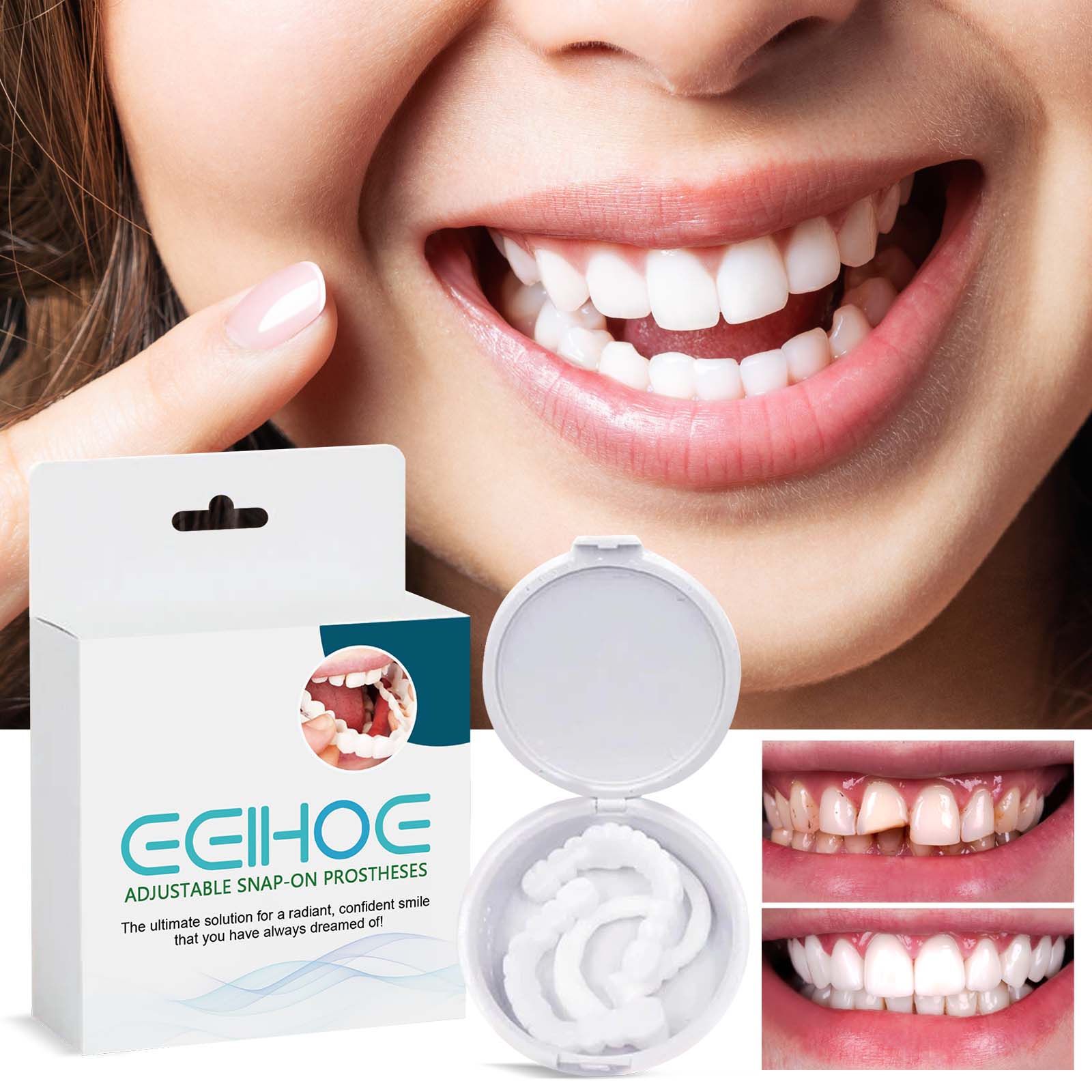 EELHOE Gentle Cosmetic Dental Kit – Anpassbare, aufsteckbare Zahnprothese, nicht-invasive ästhetische Lösung für ein schönes Lächeln, CE-zertifizierte herausnehmbare Prothese_voghion.com