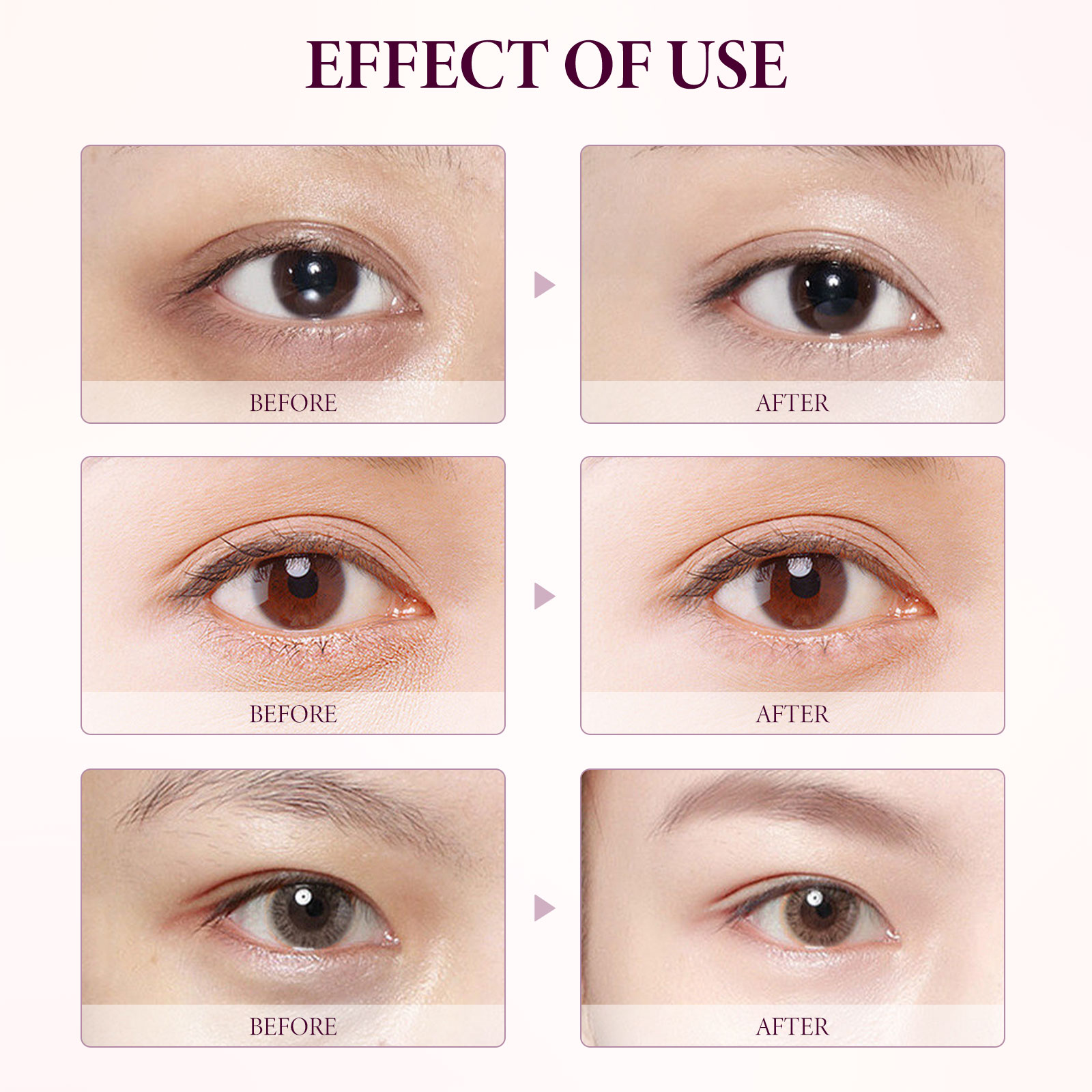 EELHOE Mango Eye Cream Reduces Fine Lines Of Crow's Feet Bags And Gently Nourishes Elasticity And Tightens The Skin Around Eyes_voghion.com