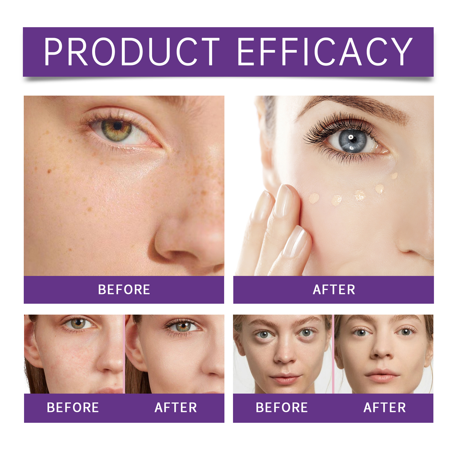 Eelhope Hydrating Blemish Proof Concealer Long Lasting Lightweight Breathable Even Skin Tone Multi Use Comfort Fit_voghion.com