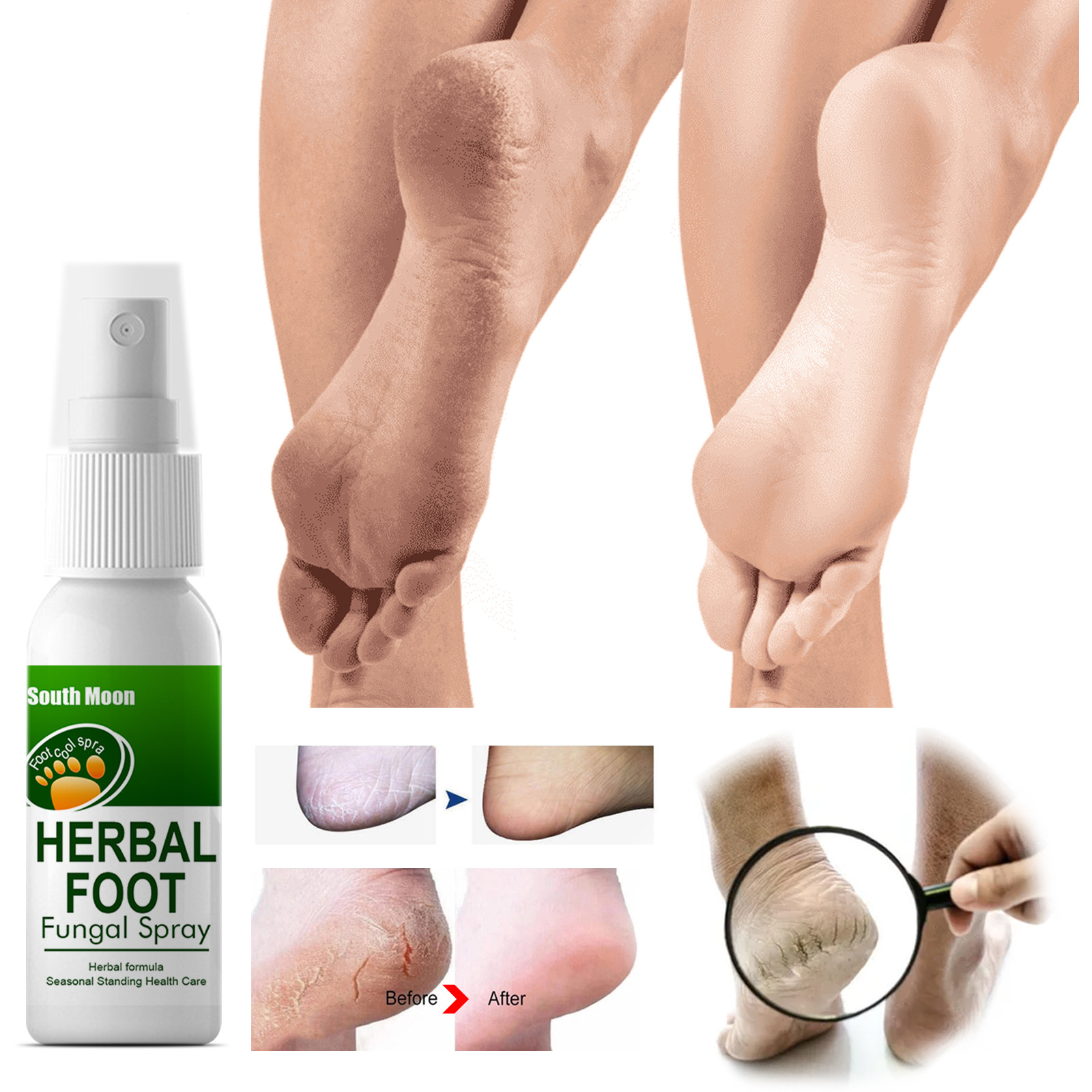 Sweat, Herbal spray Odor and Itch Relieving Foot Care Spray_voghion.com