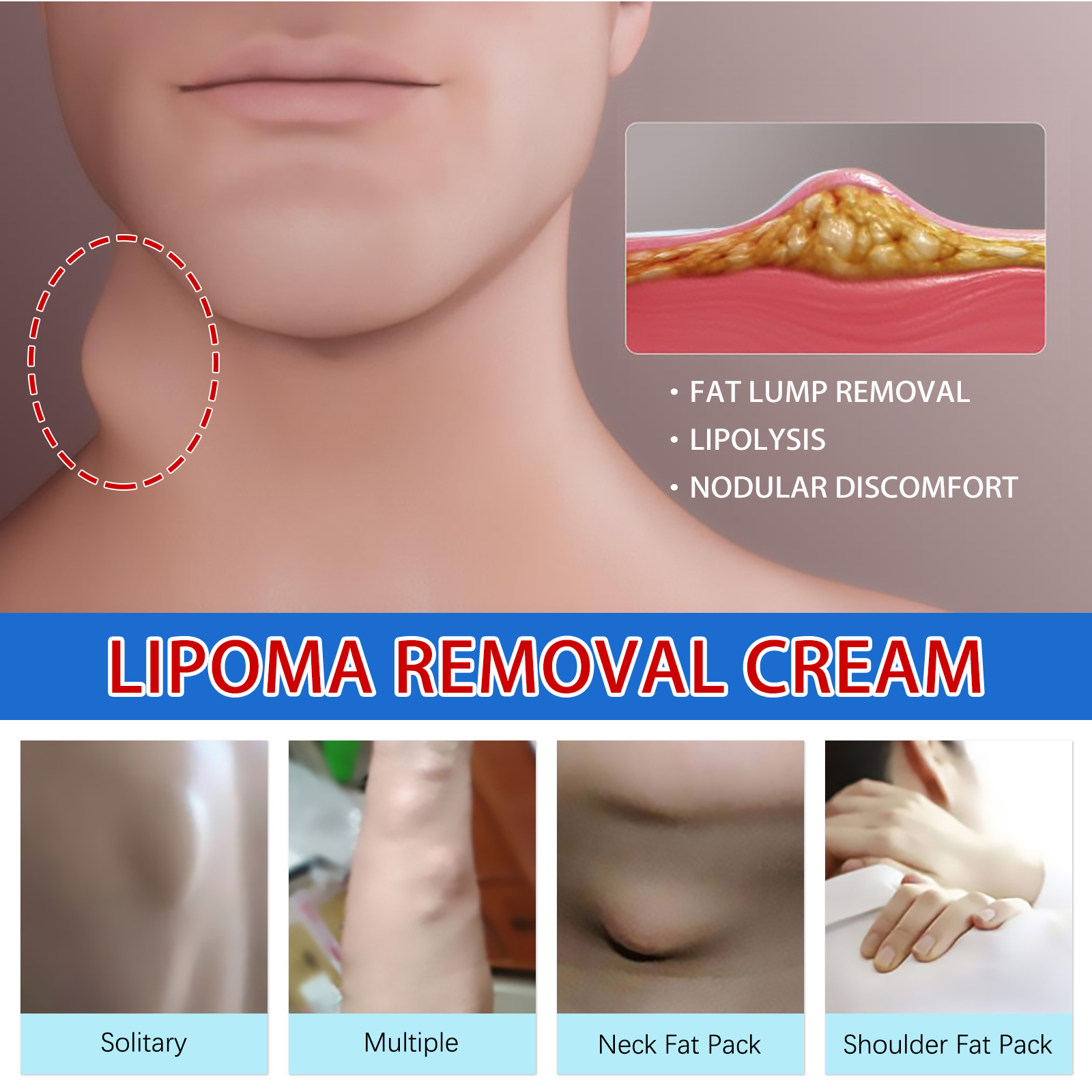 South Moon Lump allevia i tumori sottocutanei dei grumi di grasso e la crema per la cura del corpo schiarente_voghion.com