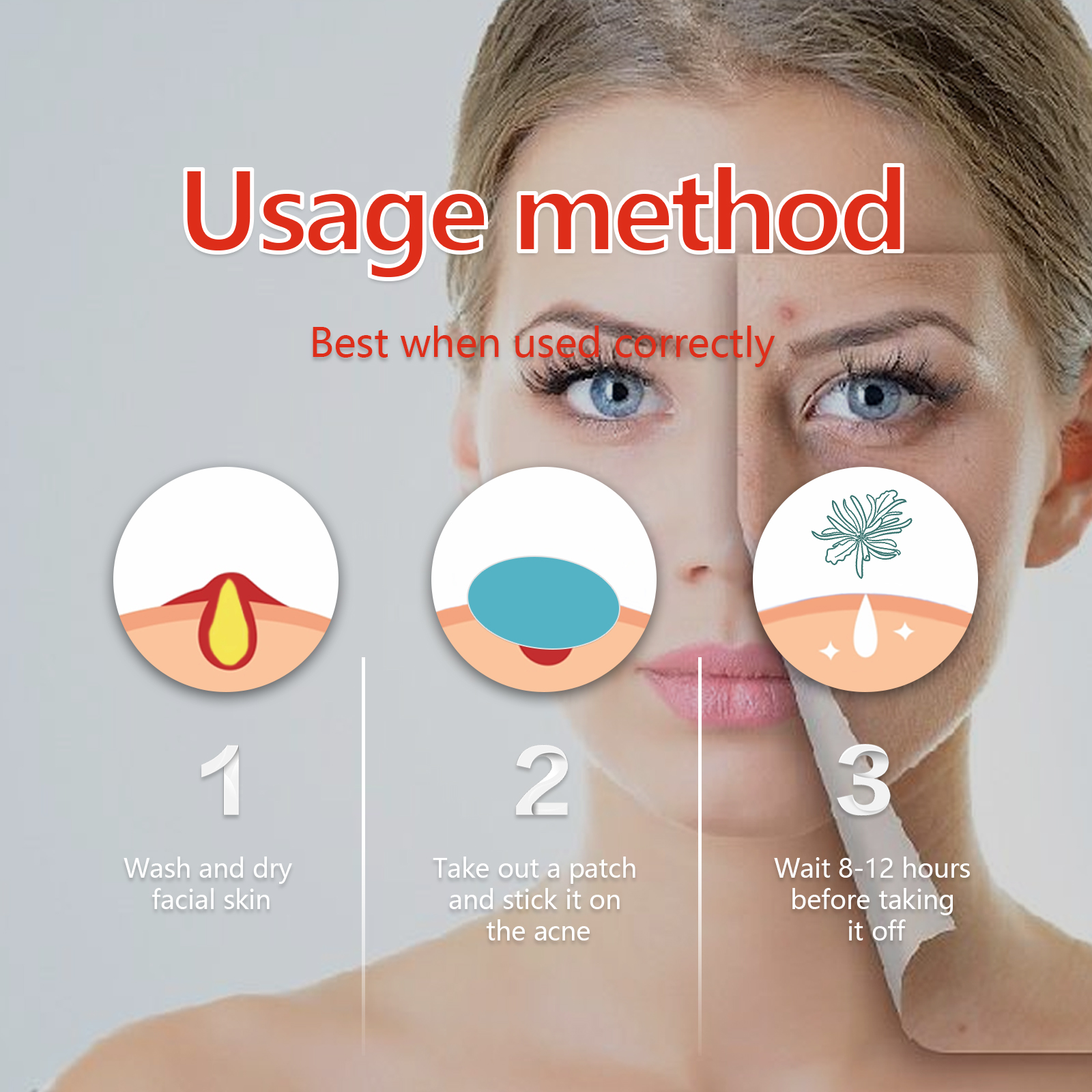 EELHOE Hydrocolloid Acne Patch, Mild Non-Irritant Lightening Acne Pimples Closed Mouth Improve Acne Muscle Hydrocolloidal Acne Patch_voghion.com