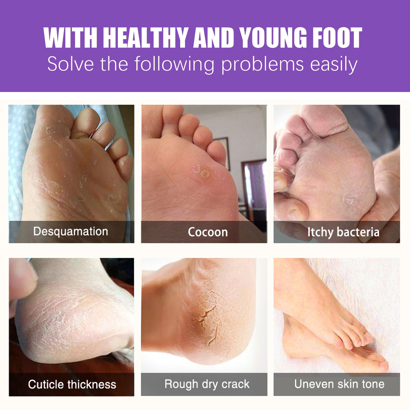 EELHOE Ginger Foot Mask (Box) Foot Moisturizing, Nourishing, Rejuvenating, Exfoliating, Removing Dead Skin, Dry And Cracked Skin Care Foot Mask_voghion.com