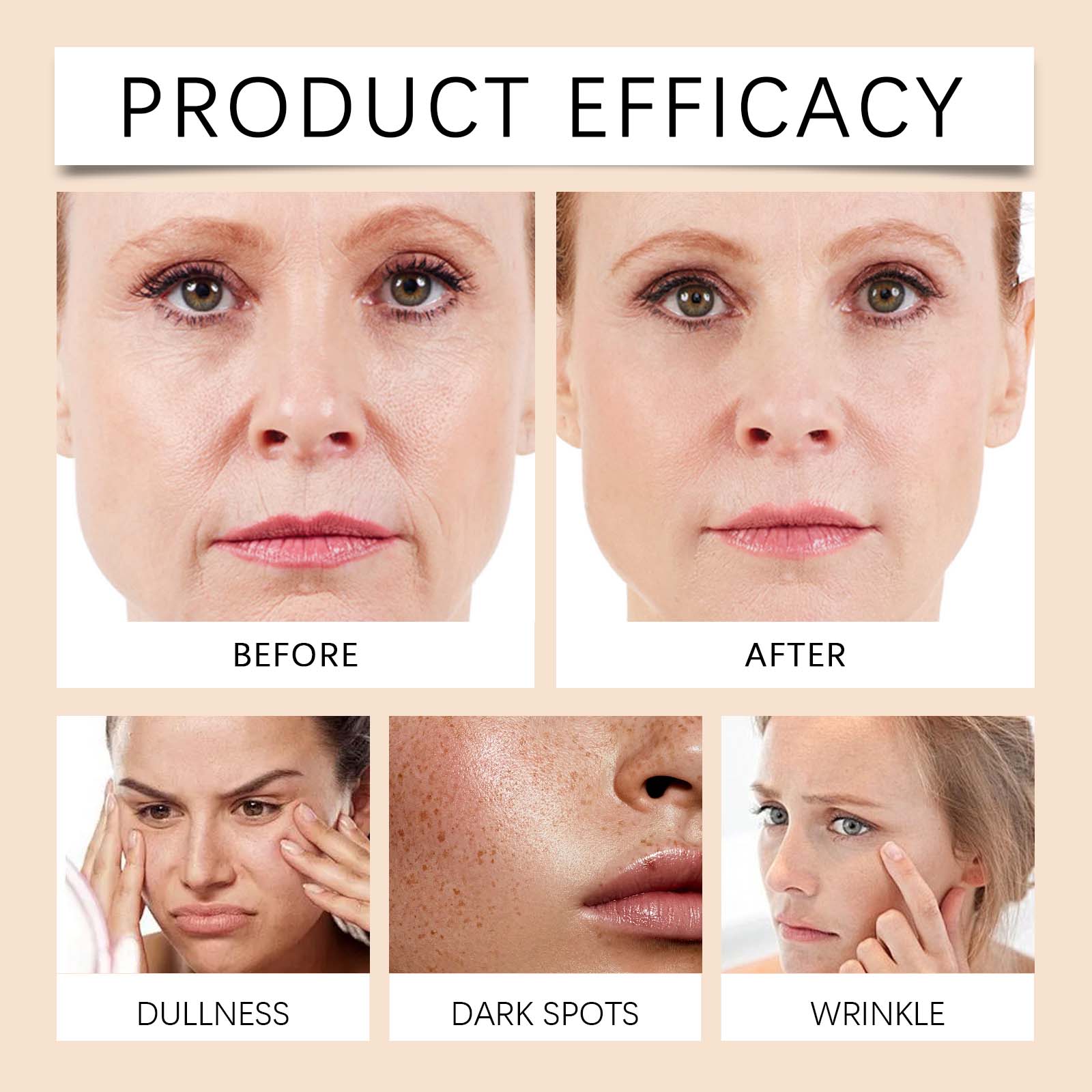 Eelhoe Deep Moisturizing Whitening Cream For Face And Eyes Hydrates And Reduces Fine Lines And Brightens Skin Whitening Cream_voghion.com
