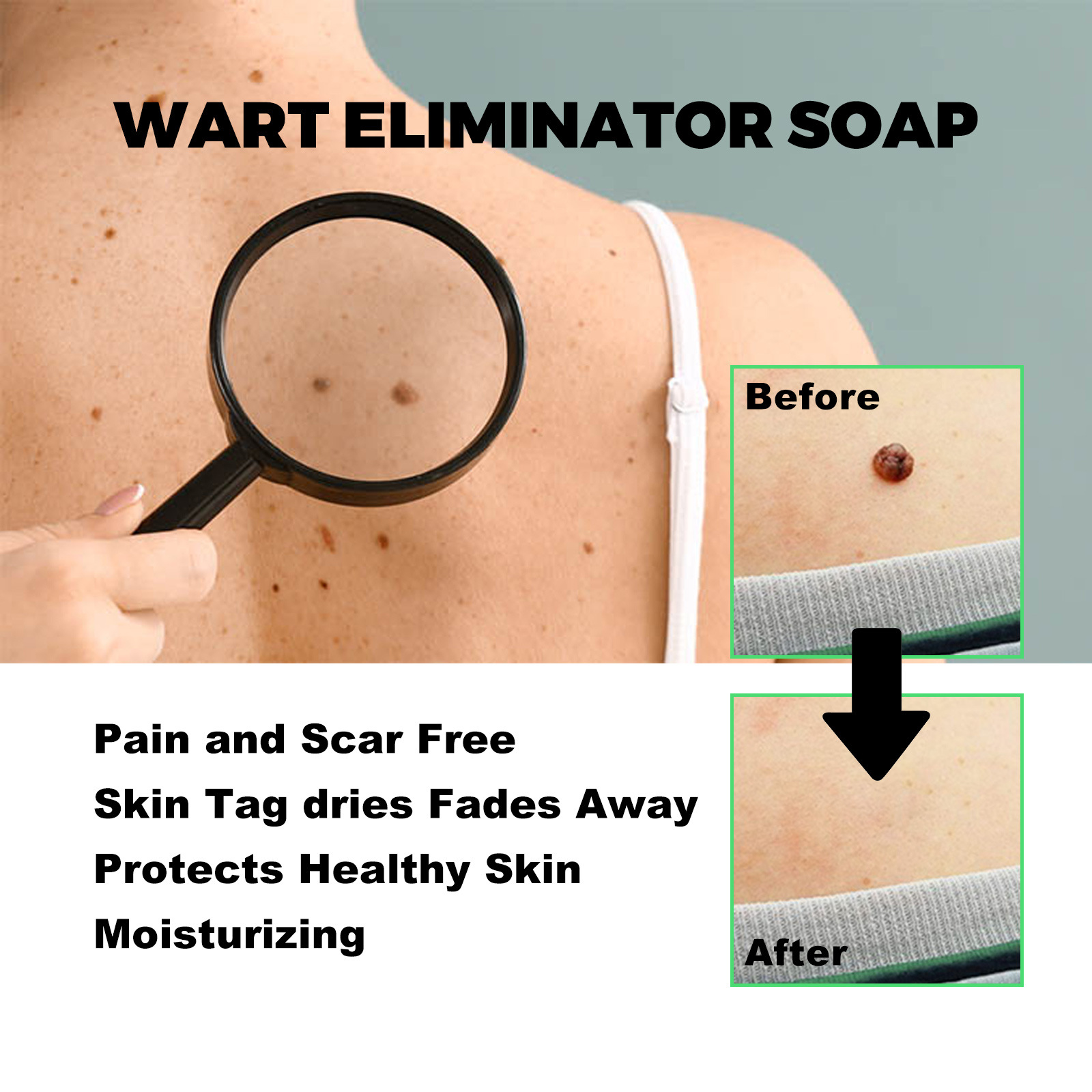 South Moon for Facial, Neck, Body, Cleaning and Care Anti wart Smooth Skin Soap_voghion.com