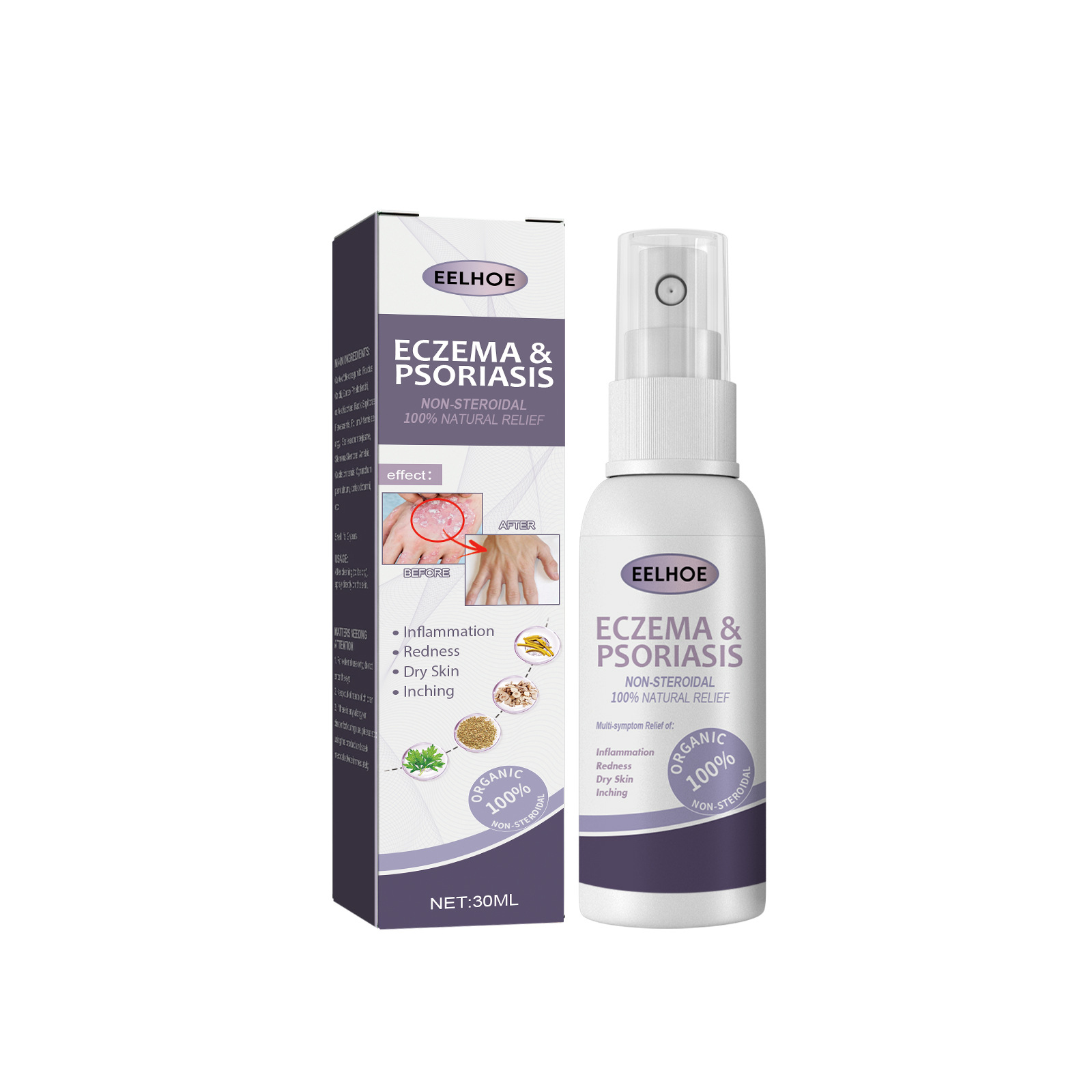 EELHOE riparazione del muschio mano-piede per alleviare il prurito e spray per la cura della pelle Jiejia_voghion.com