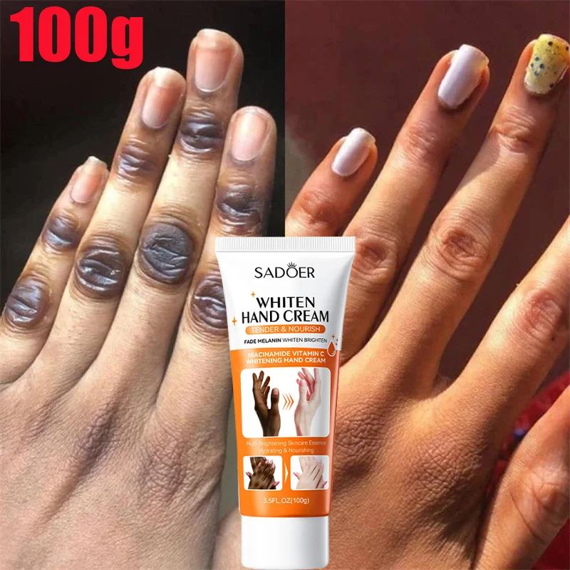 Dark Knuckles Whitening Hand Cream Pigmentation Correctors Anti Cracking Serum Black Skin Fast Stains Remover Skin Care Products