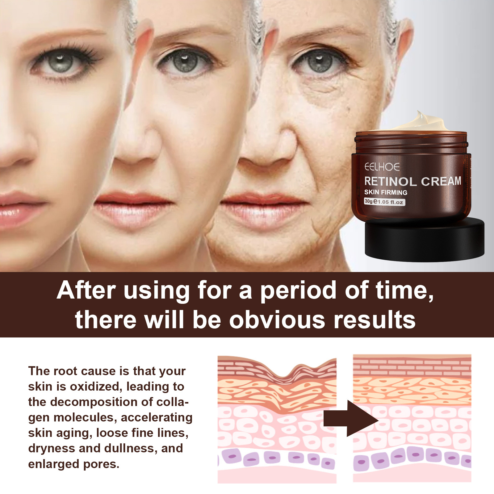 EELHOE crème visage rétinol Anti-âge rides Lifting ton éclaircissant hydratant visage raffermissant crème de soin de la peau_voghion.com