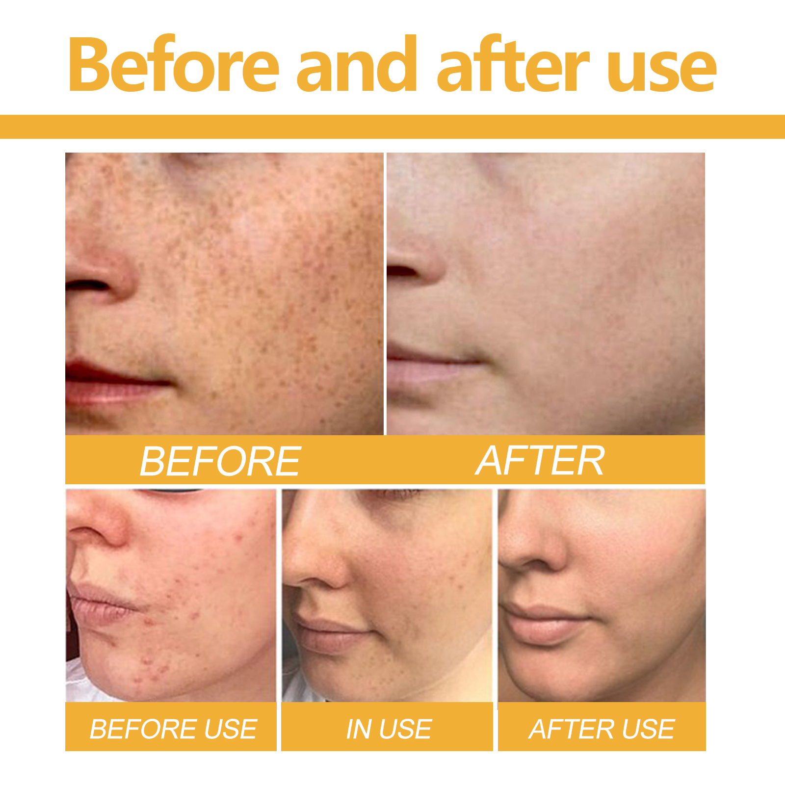 EELHOE Turmeric & Kojic Acid Soap, Gently Clean Face Fade Spots Brighten Skin Tone Moisturize And Moisturize Even Skin Tone_voghion.com
