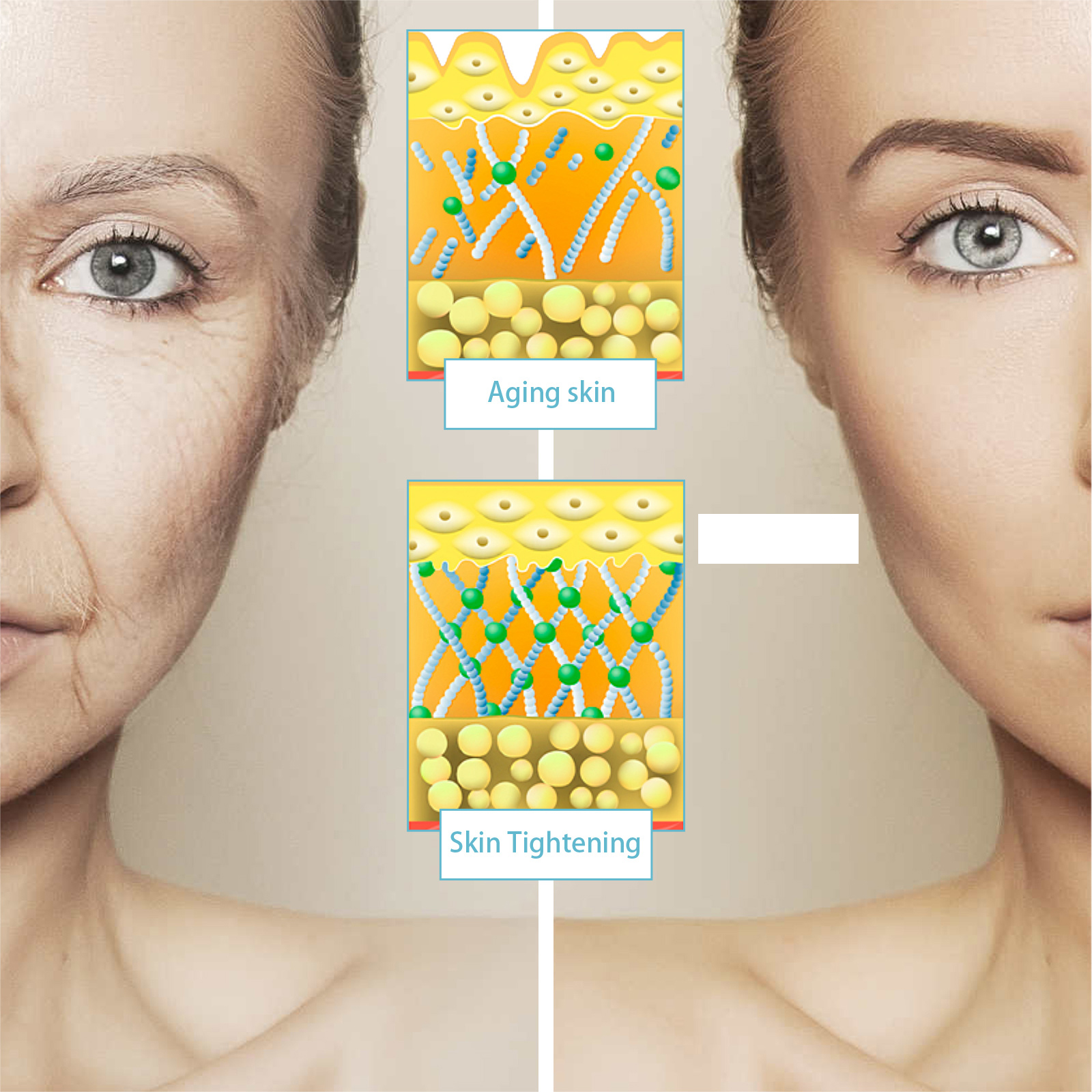 EELHOE Collagen Boost Lift Cream, Lighten Wrinkles By Moisturizing And Firming Skin Anti-Aging Cream_voghion.com
