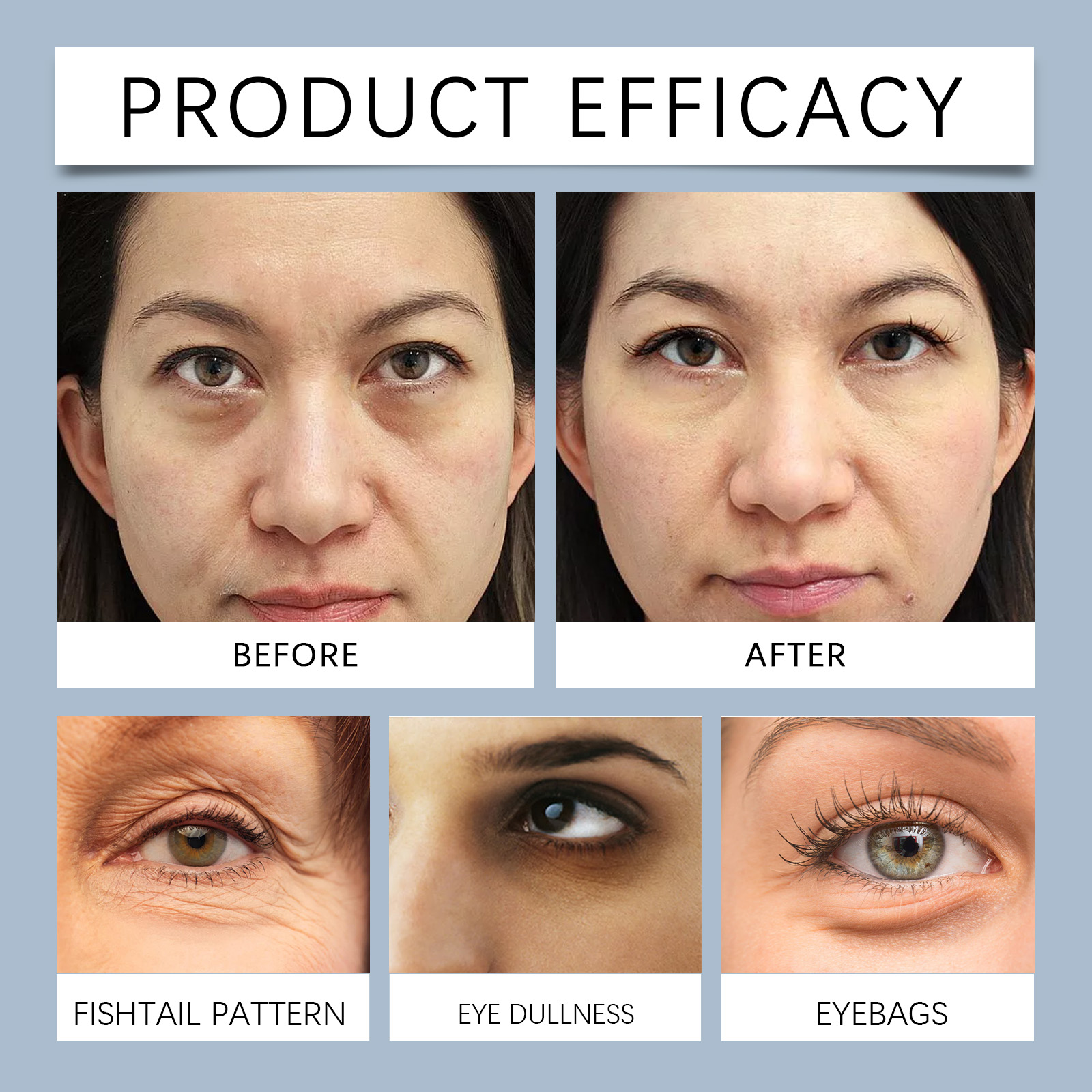 EELHOE Eye Mask Patch Hydrates And Moisturizes The Skin Around The Eyes, Lightening Fine Lines, Moisturizing And Brightening Eye Care_voghion.com
